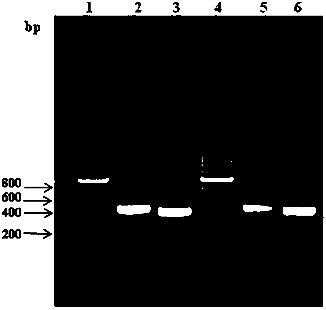 Anti-human crp antibody and its application