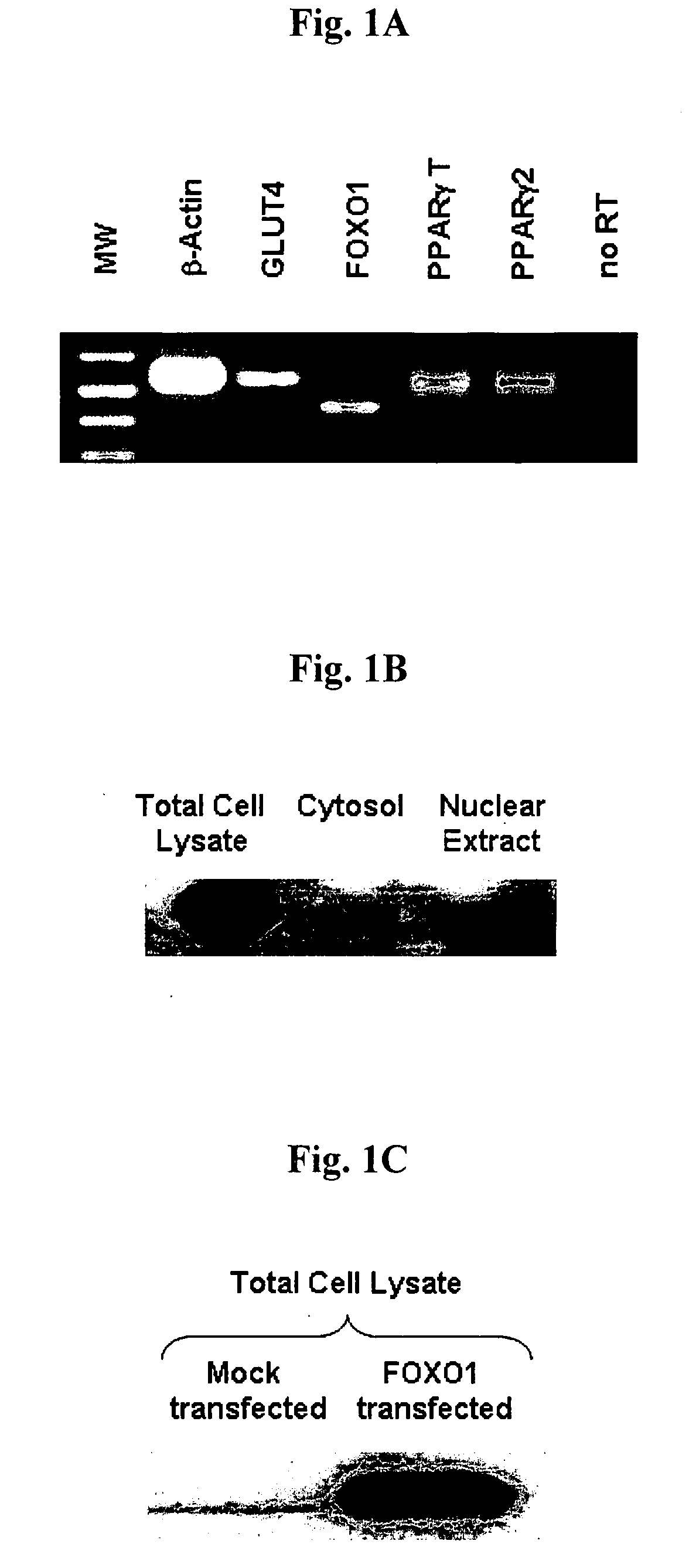 Modulation of PPARgamma2 gene promoter by FOXO1