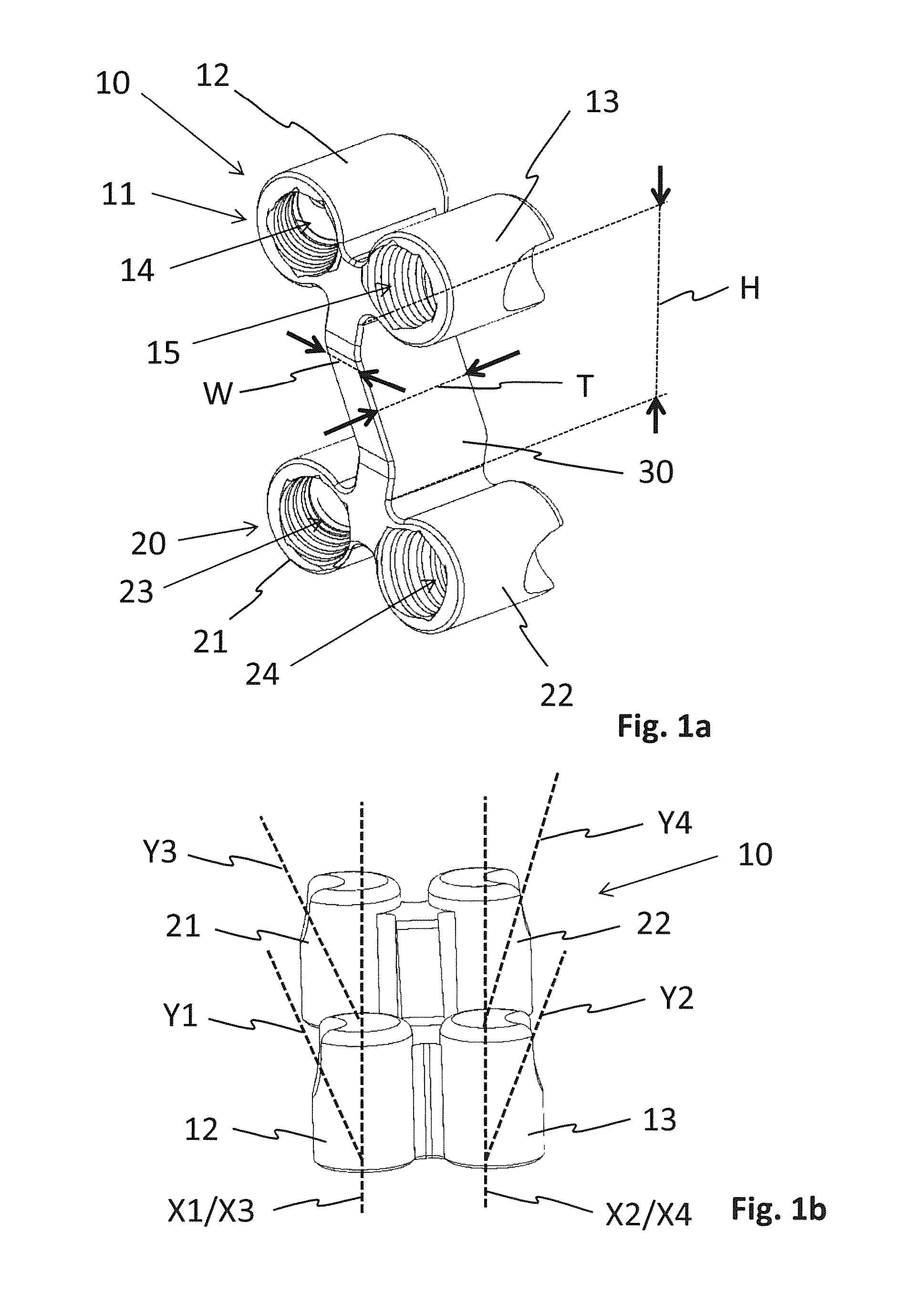 Osteotomy implant