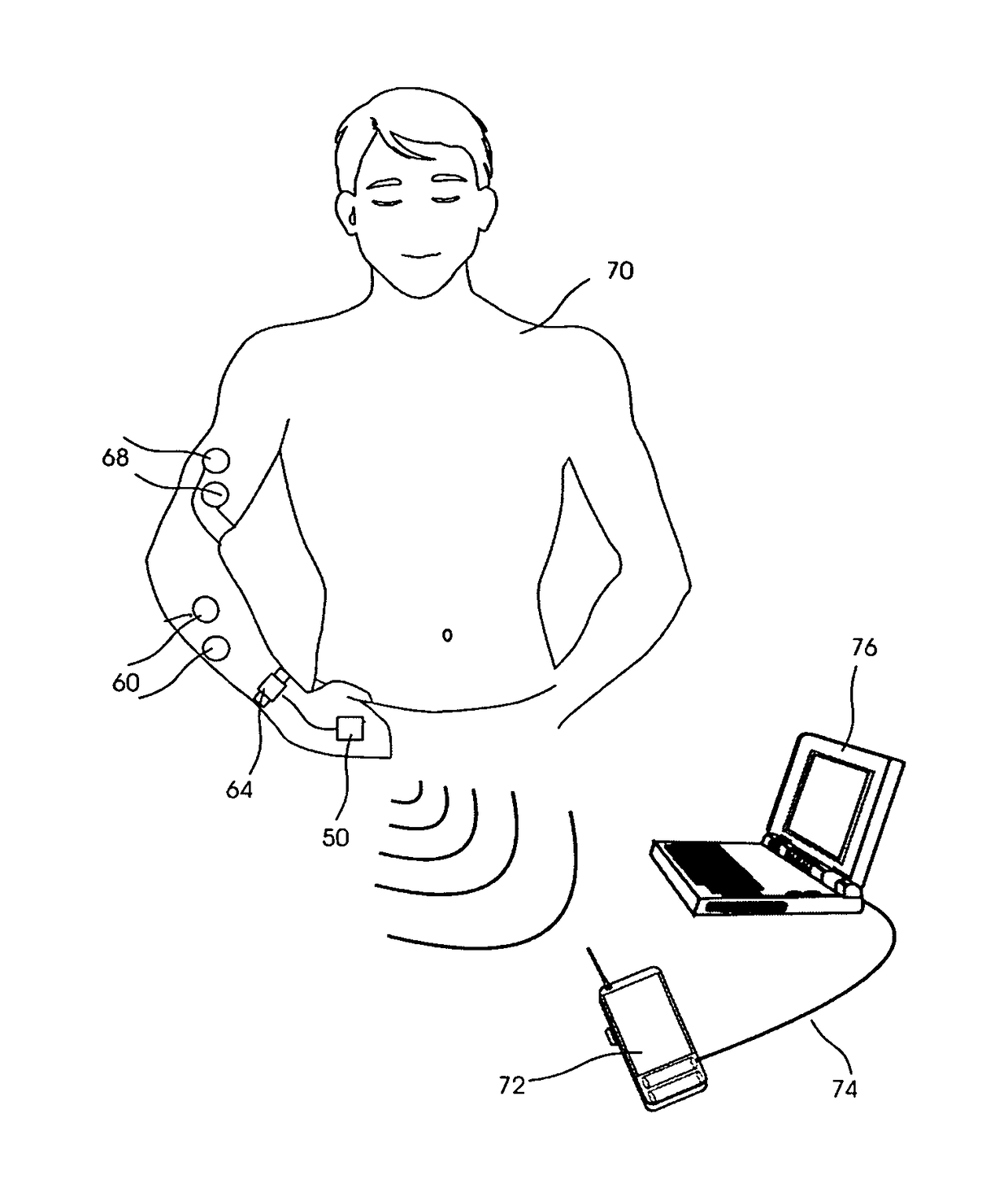 Movement disorder recovery system and method