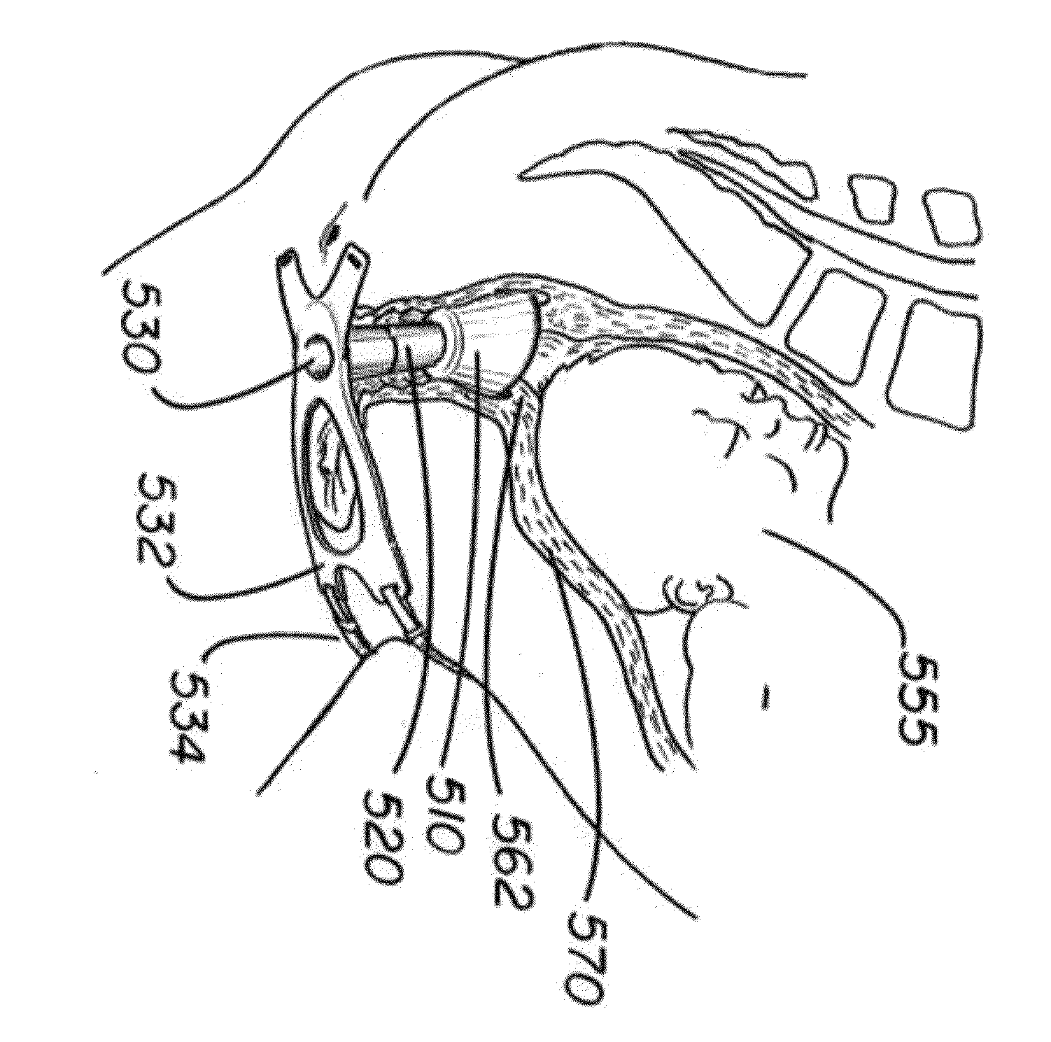 Cervical stabilization device