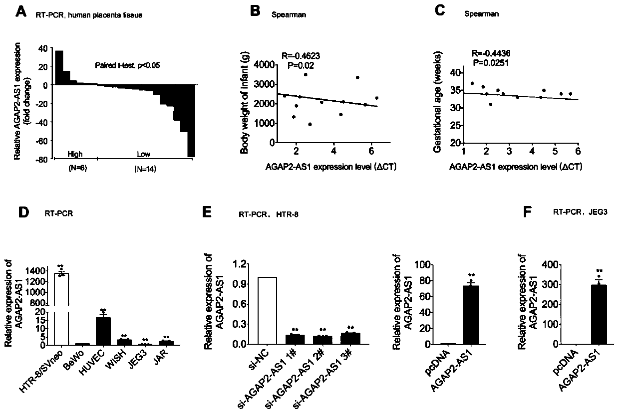 Long non-coding RNA and application thereof in diagnosis/treatment of preeclampsia