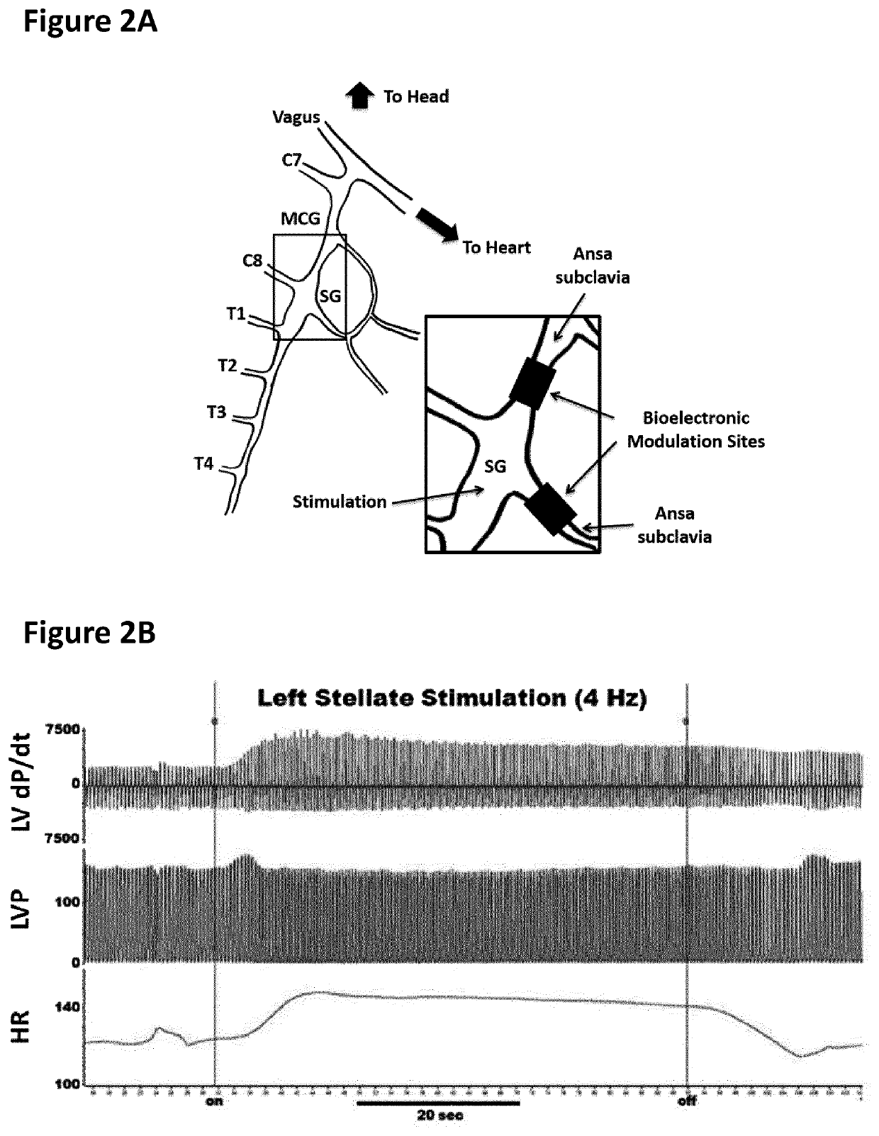 Treatment of cardiac dysfunction