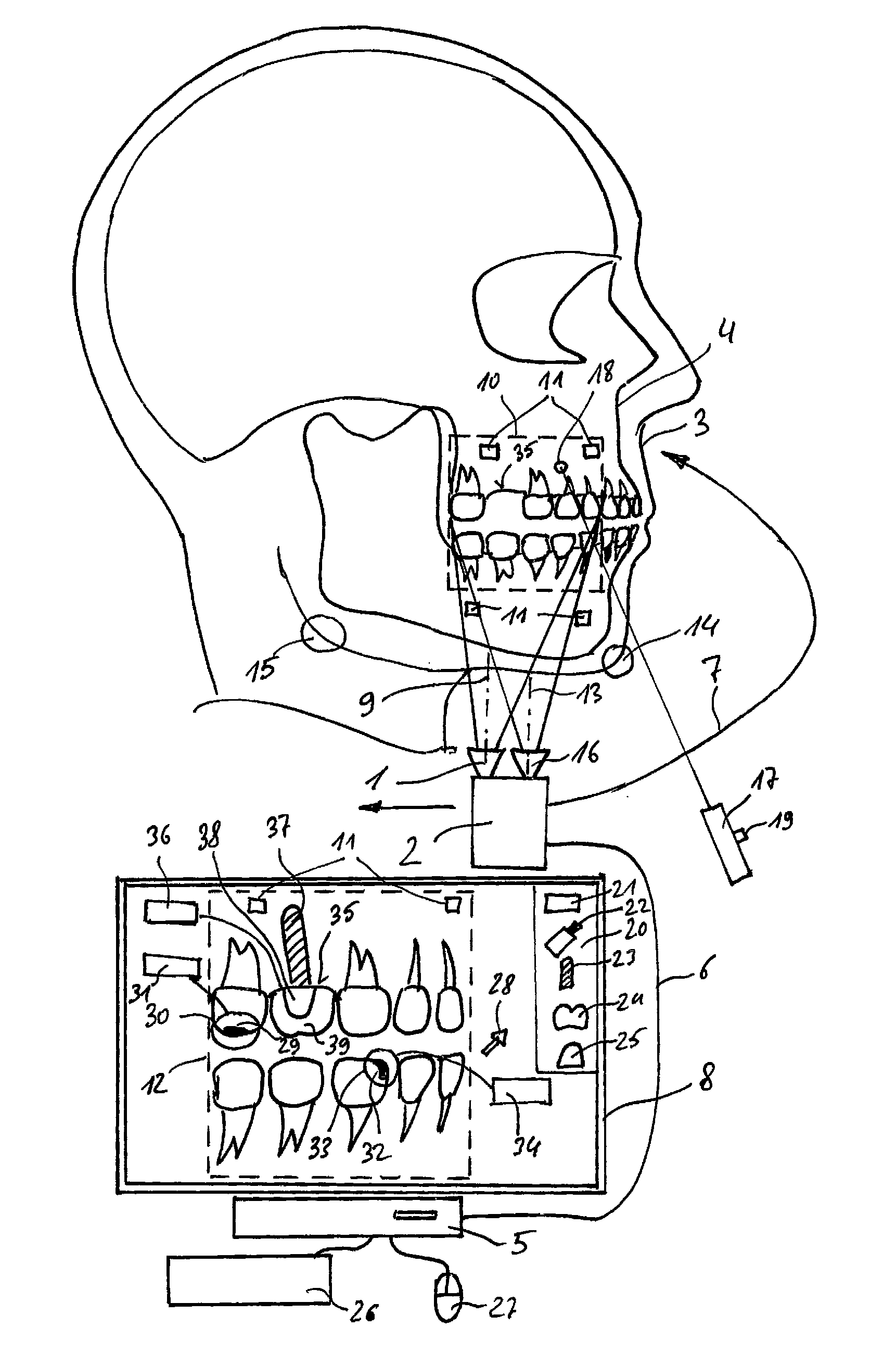 Method for planning a dental treatment