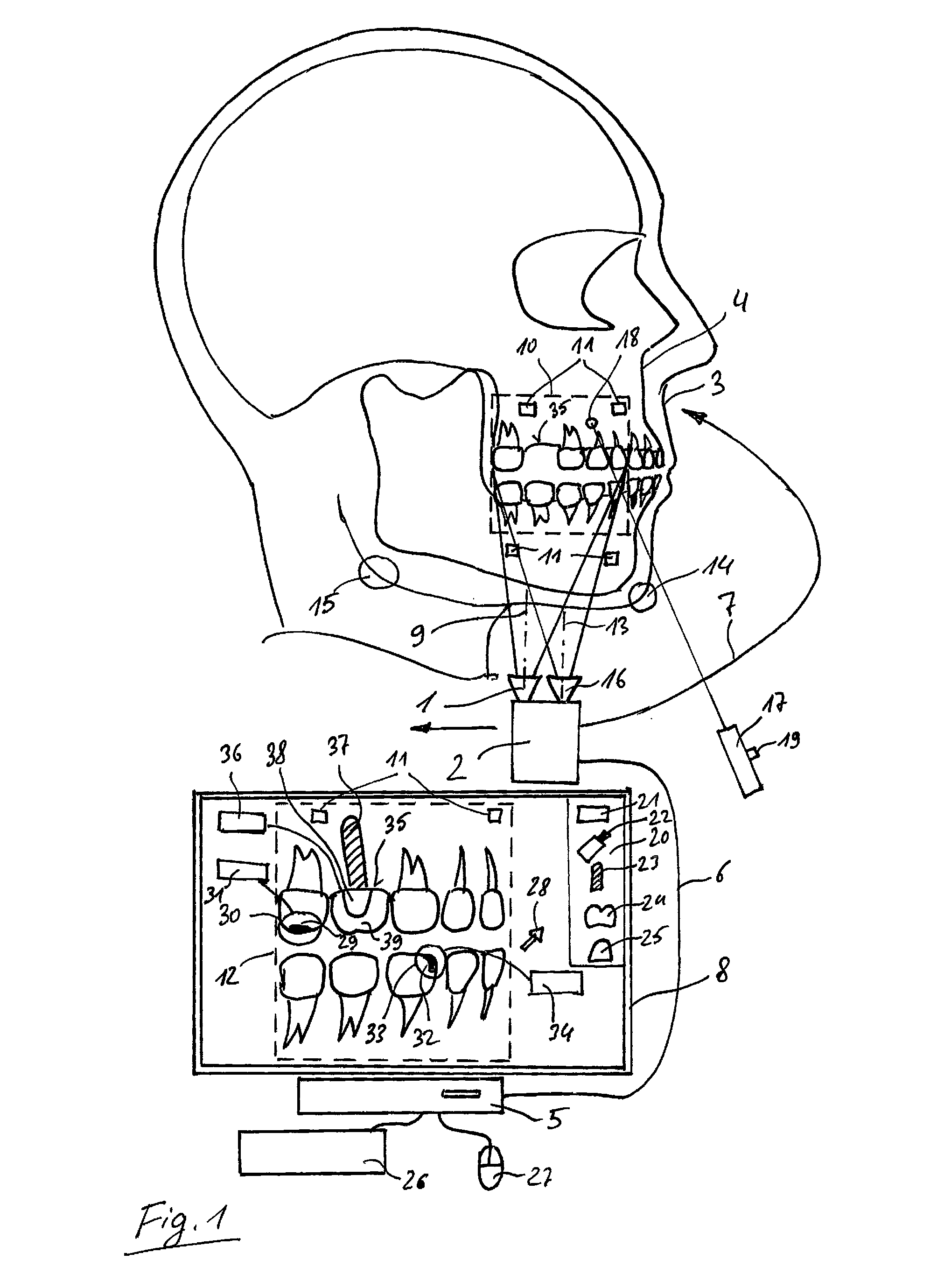 Method for planning a dental treatment