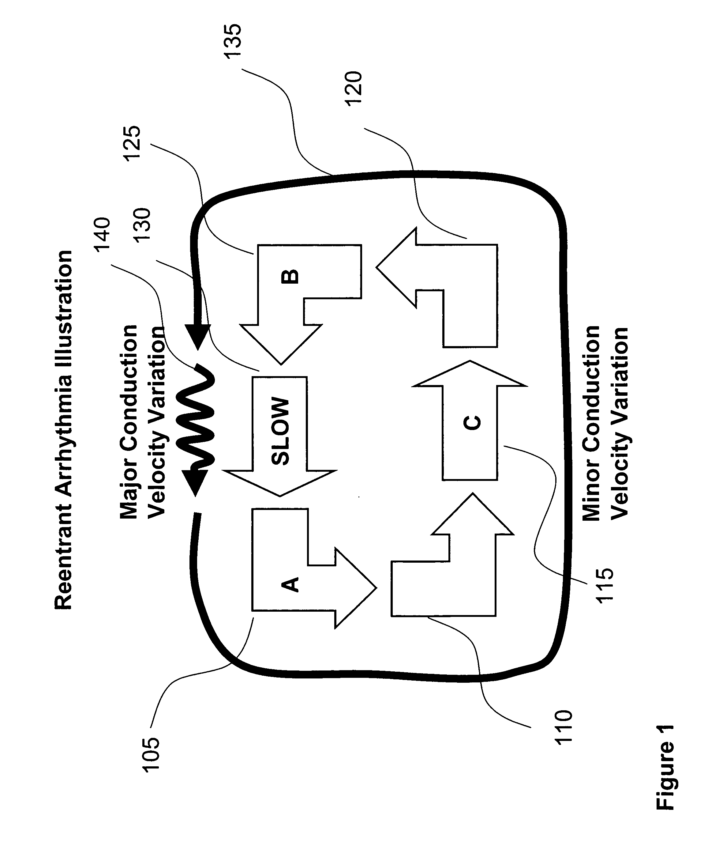 System and method for analysis of cardiac arrhythmia using timing and variability of relationships between elctrogram features