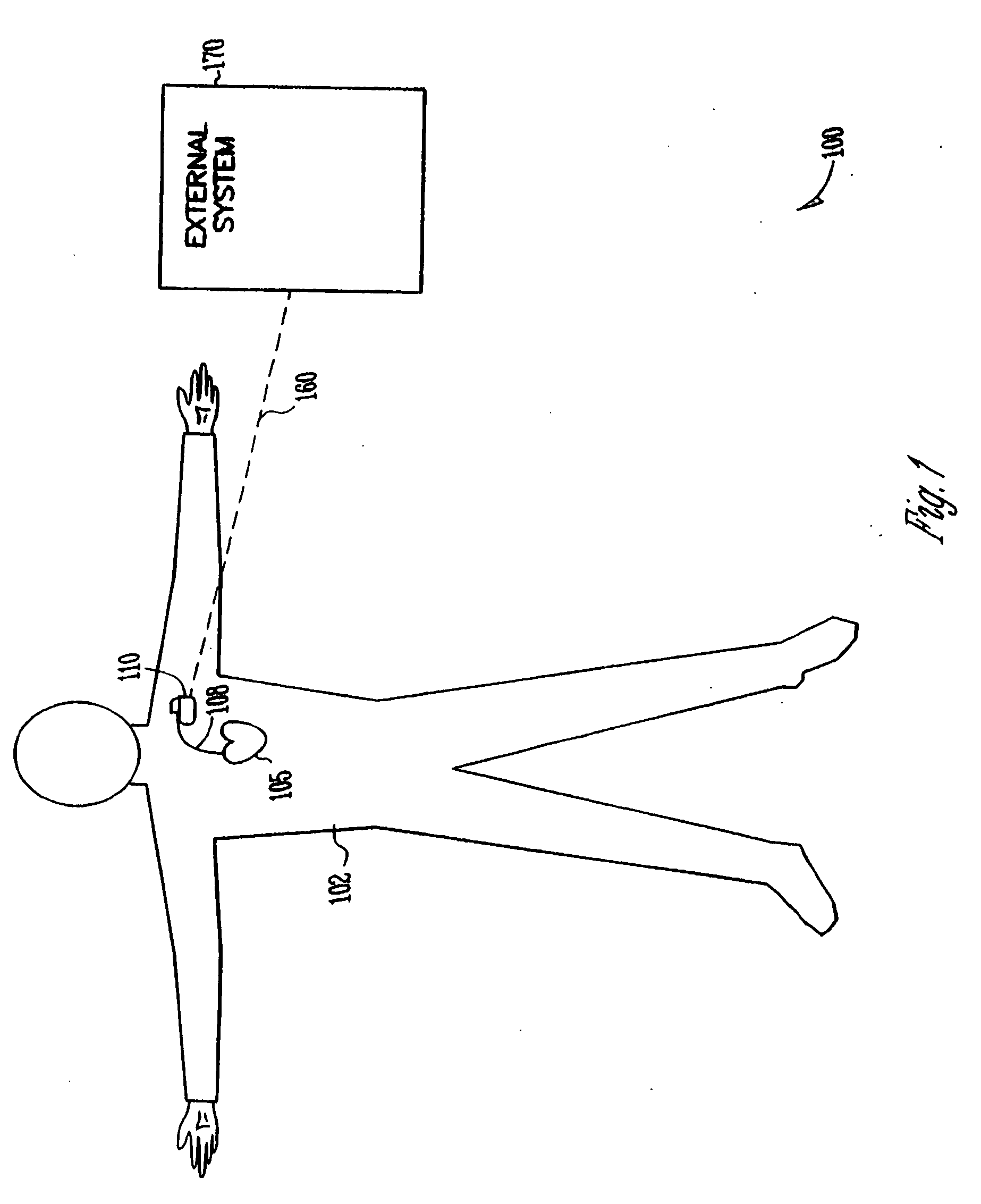 Method for correction of posture dependence on heart sounds