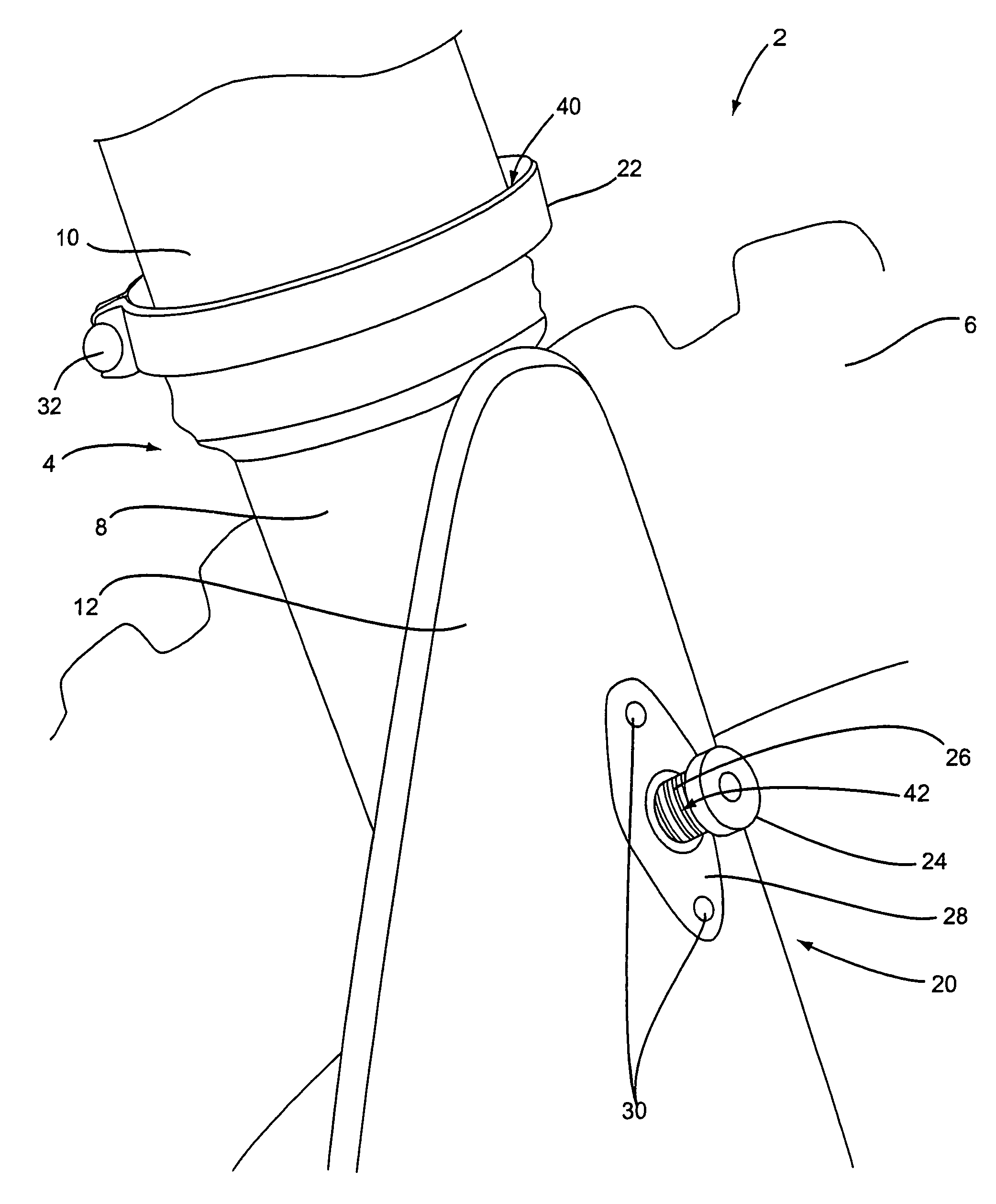 Suspension restraint devices