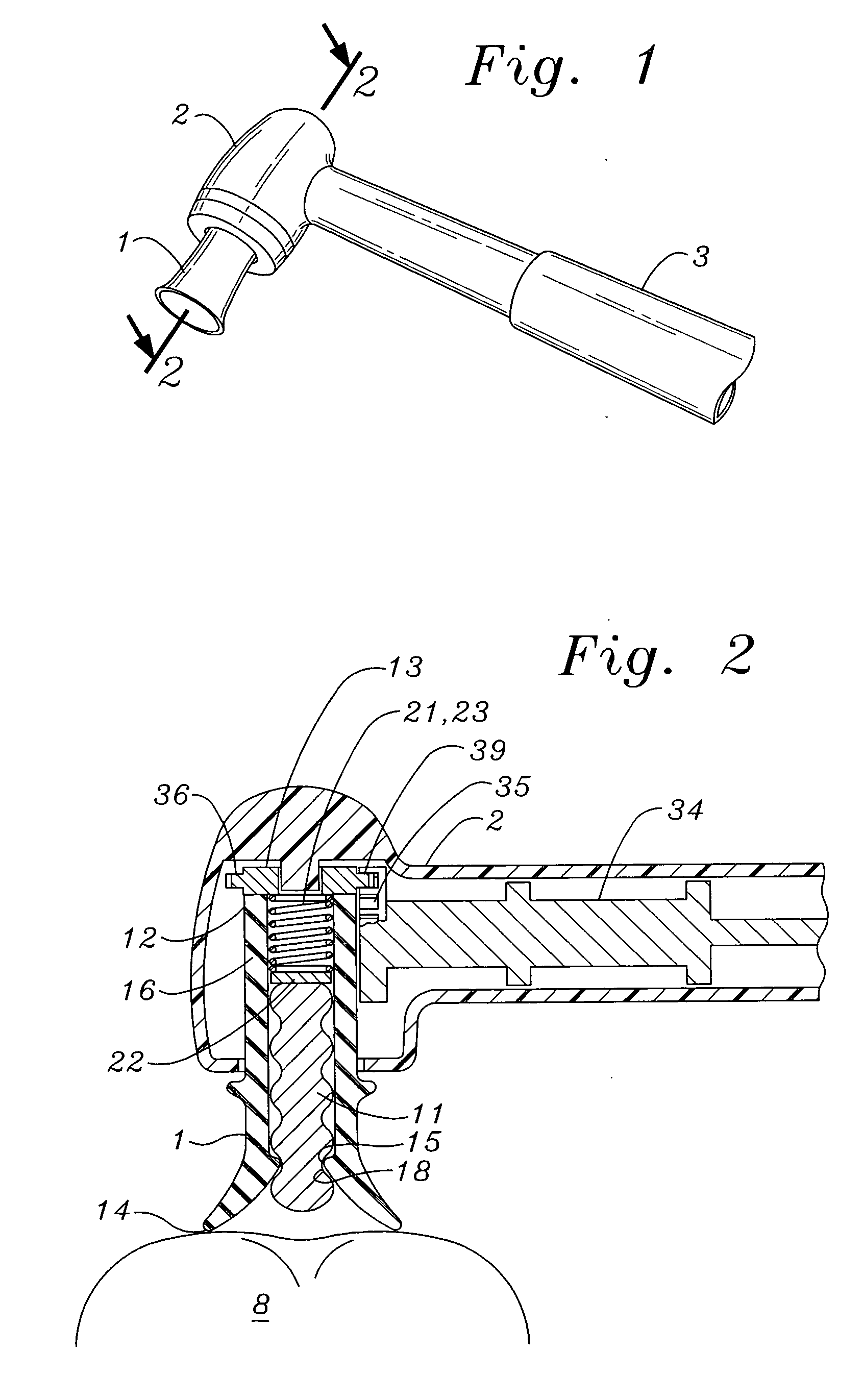 All-in-one prophy angle