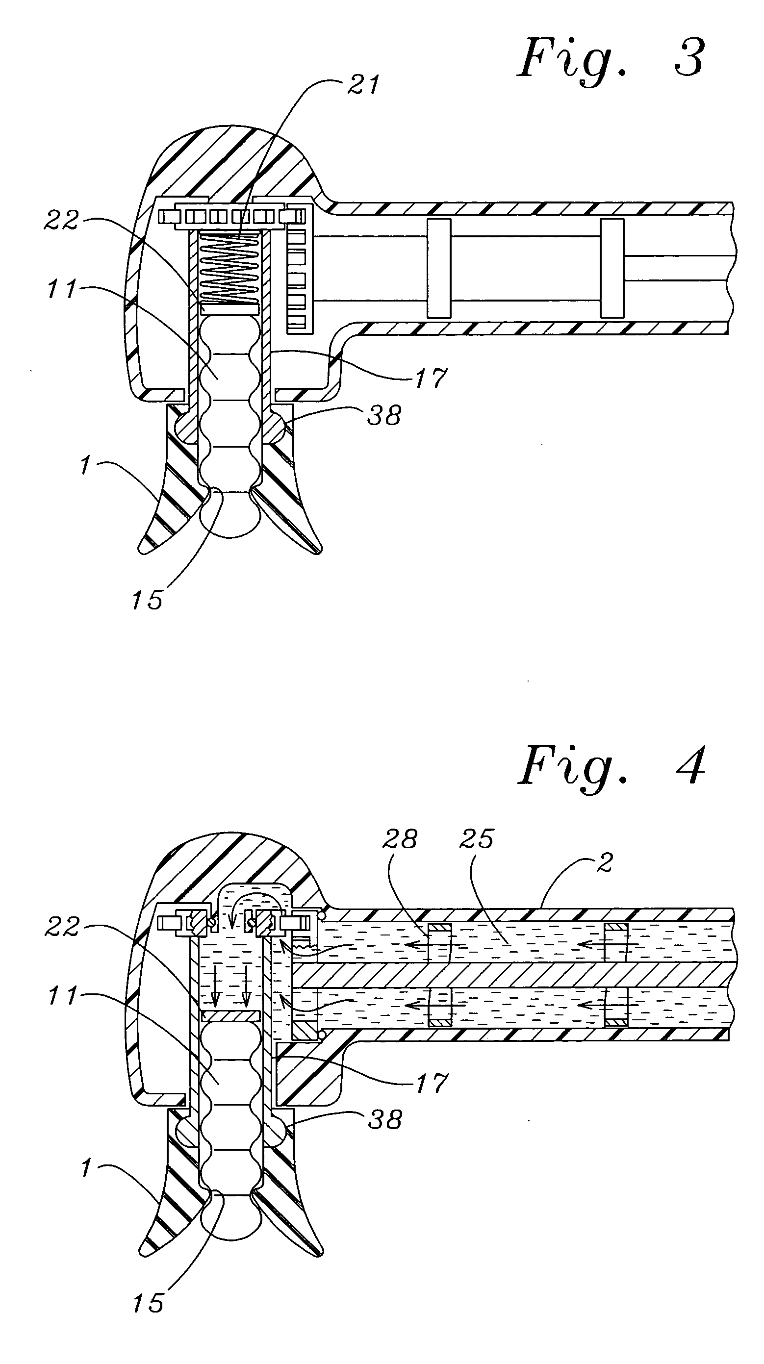 All-in-one prophy angle