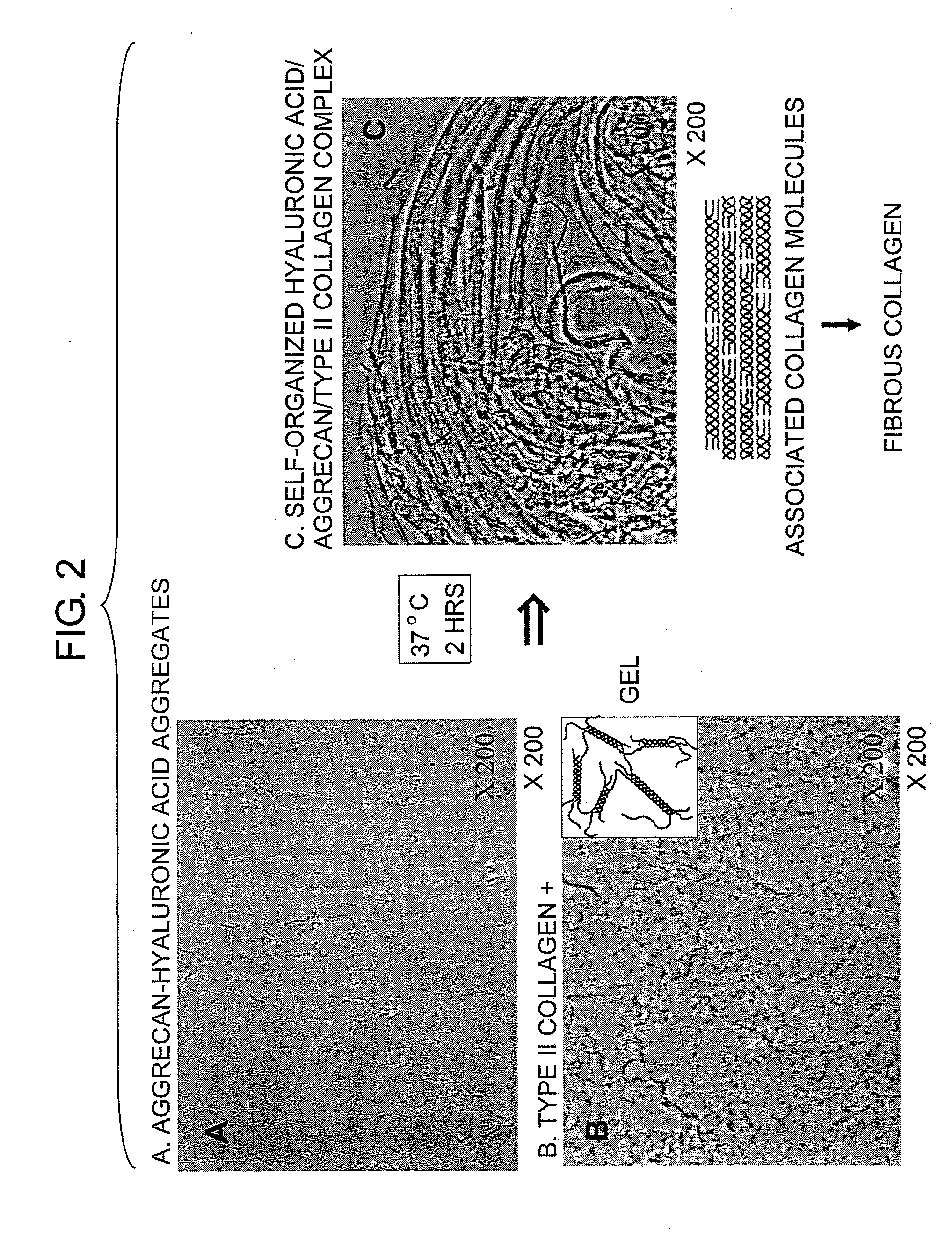 Biomaterials for regenerative medicine