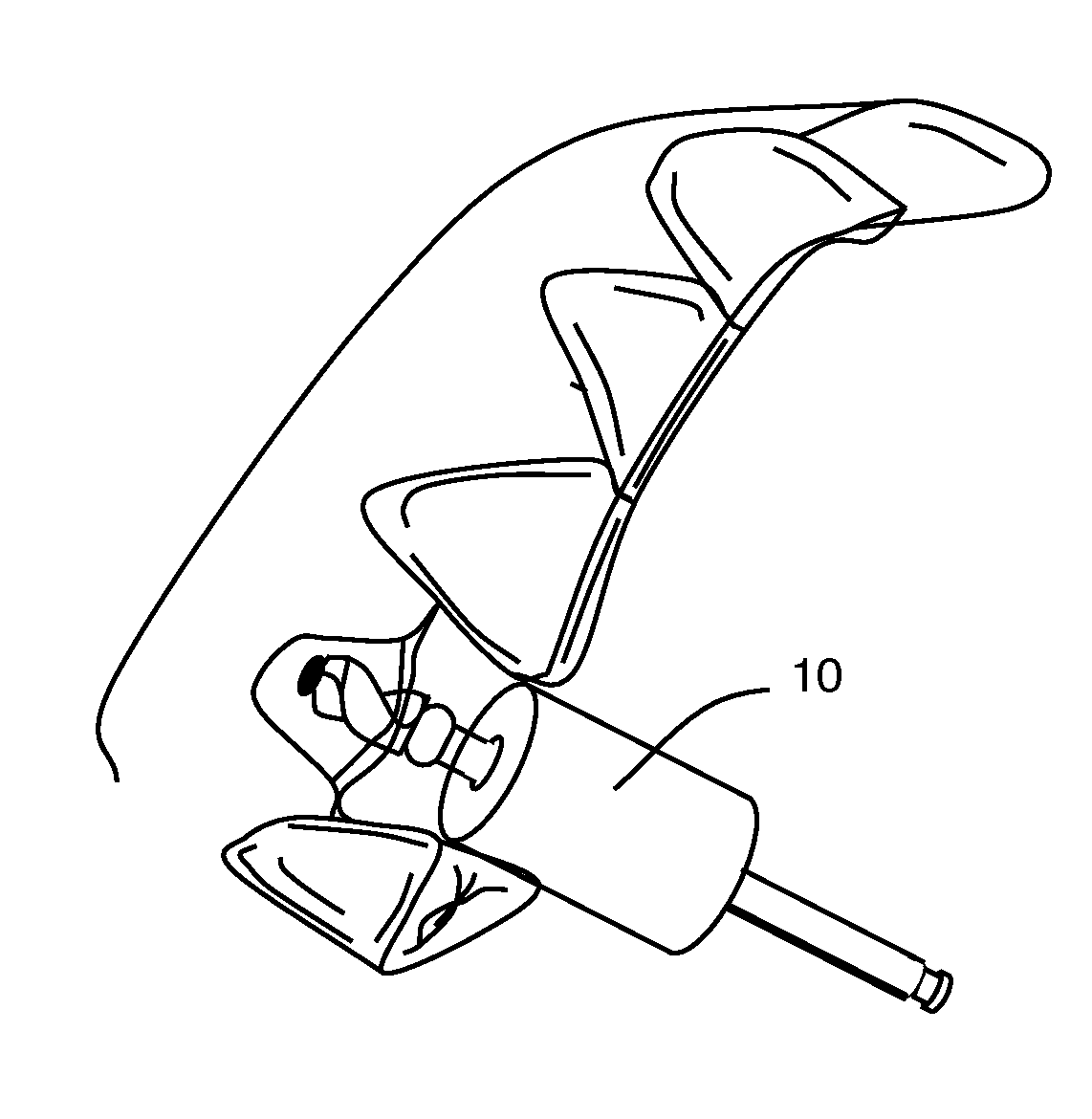 Dental implant locating device and method of use.