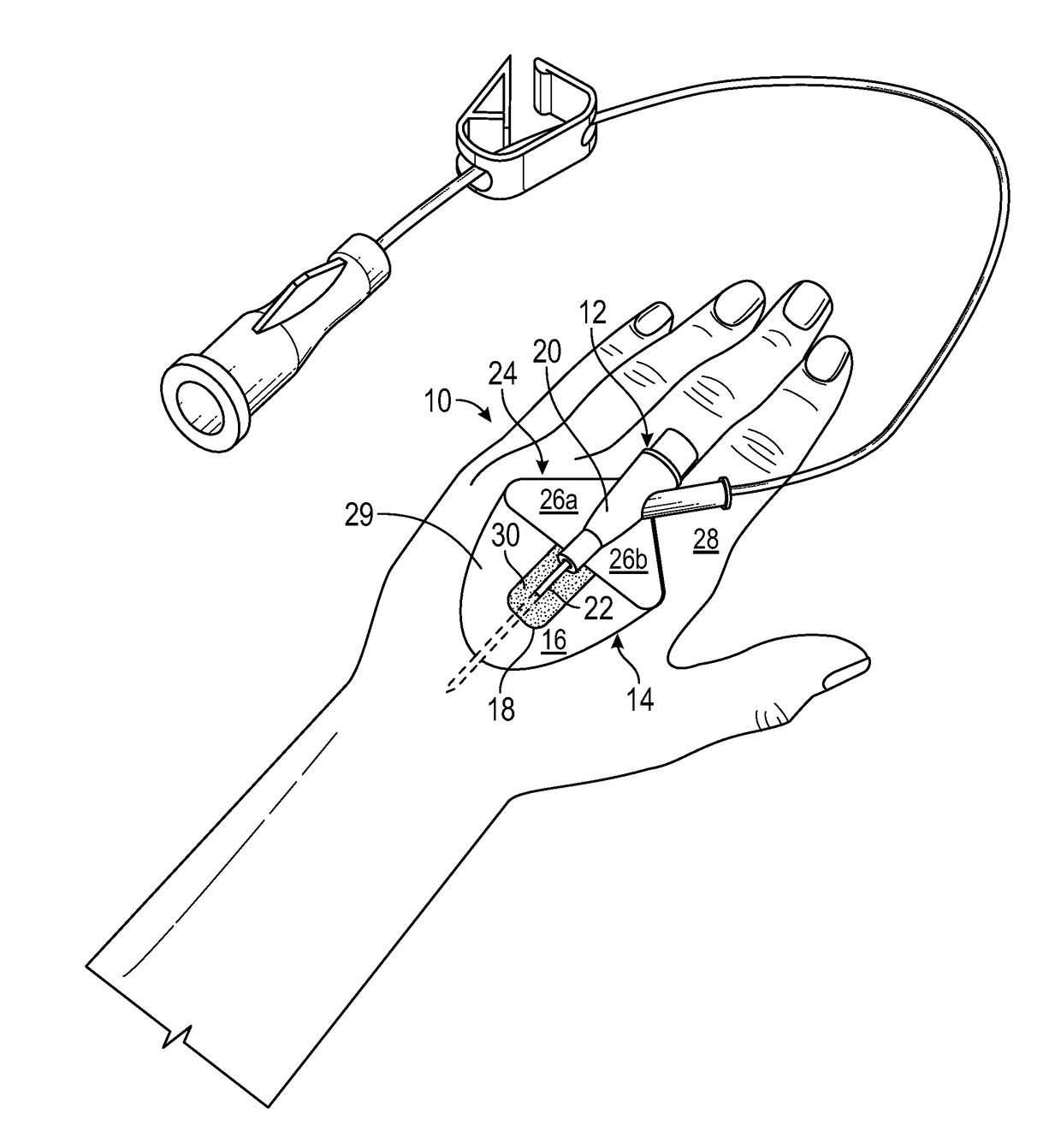 Integrated vascular access device and anchor pad