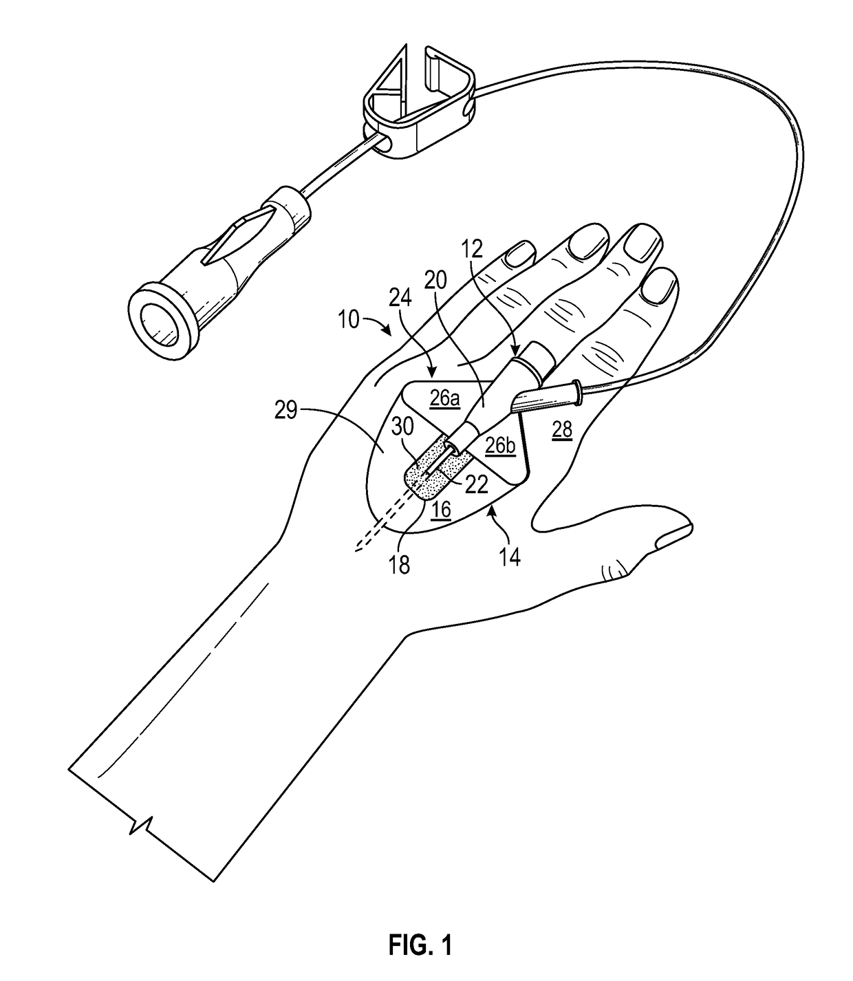 Integrated vascular access device and anchor pad