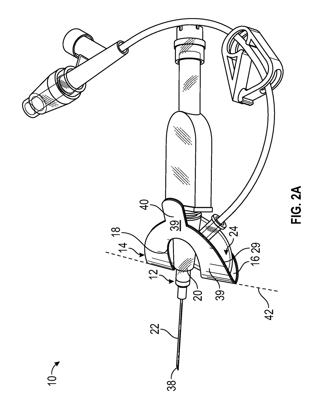 Integrated vascular access device and anchor pad