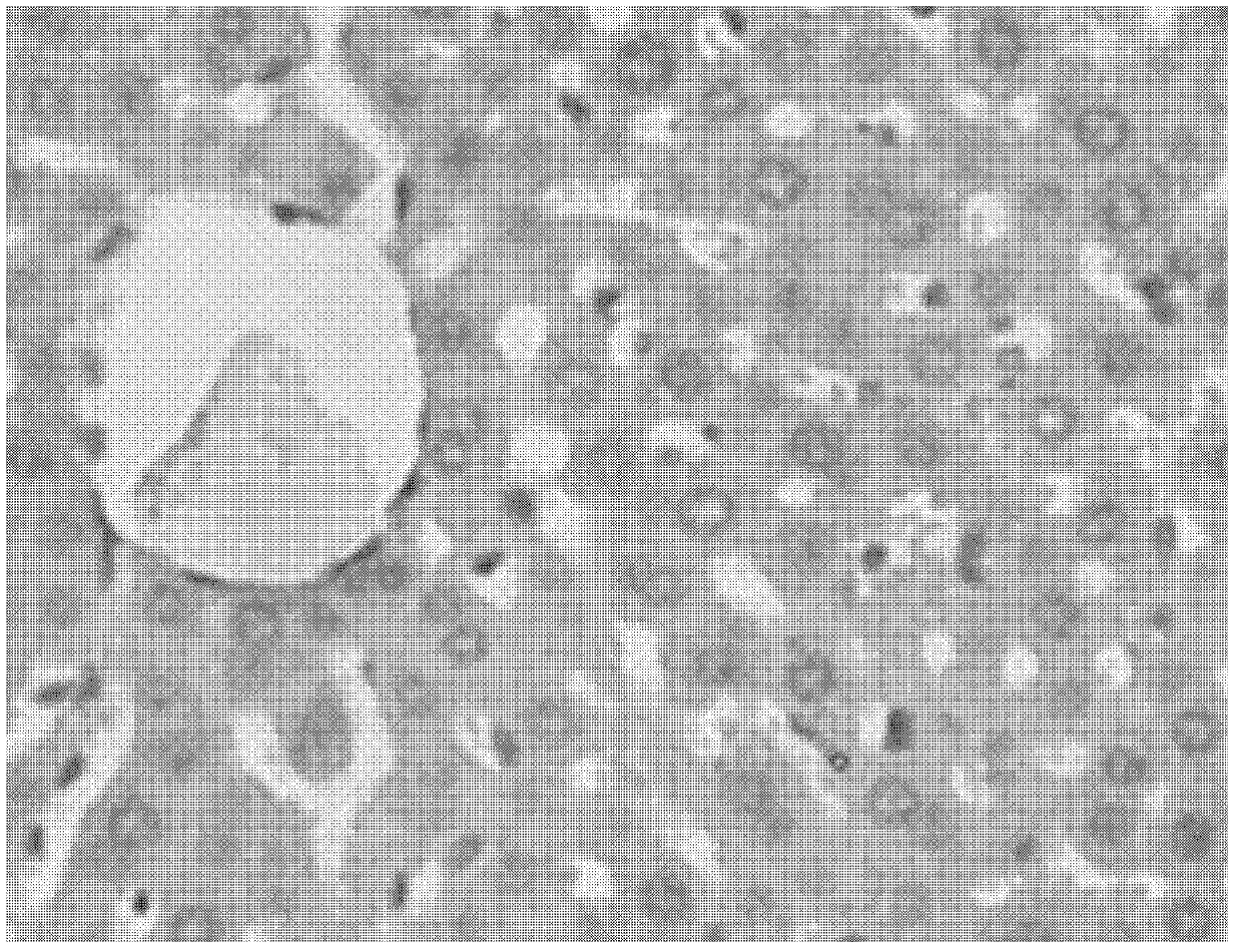 Application of medicine composition in preparation of medicines for preventing or treating fatty liver