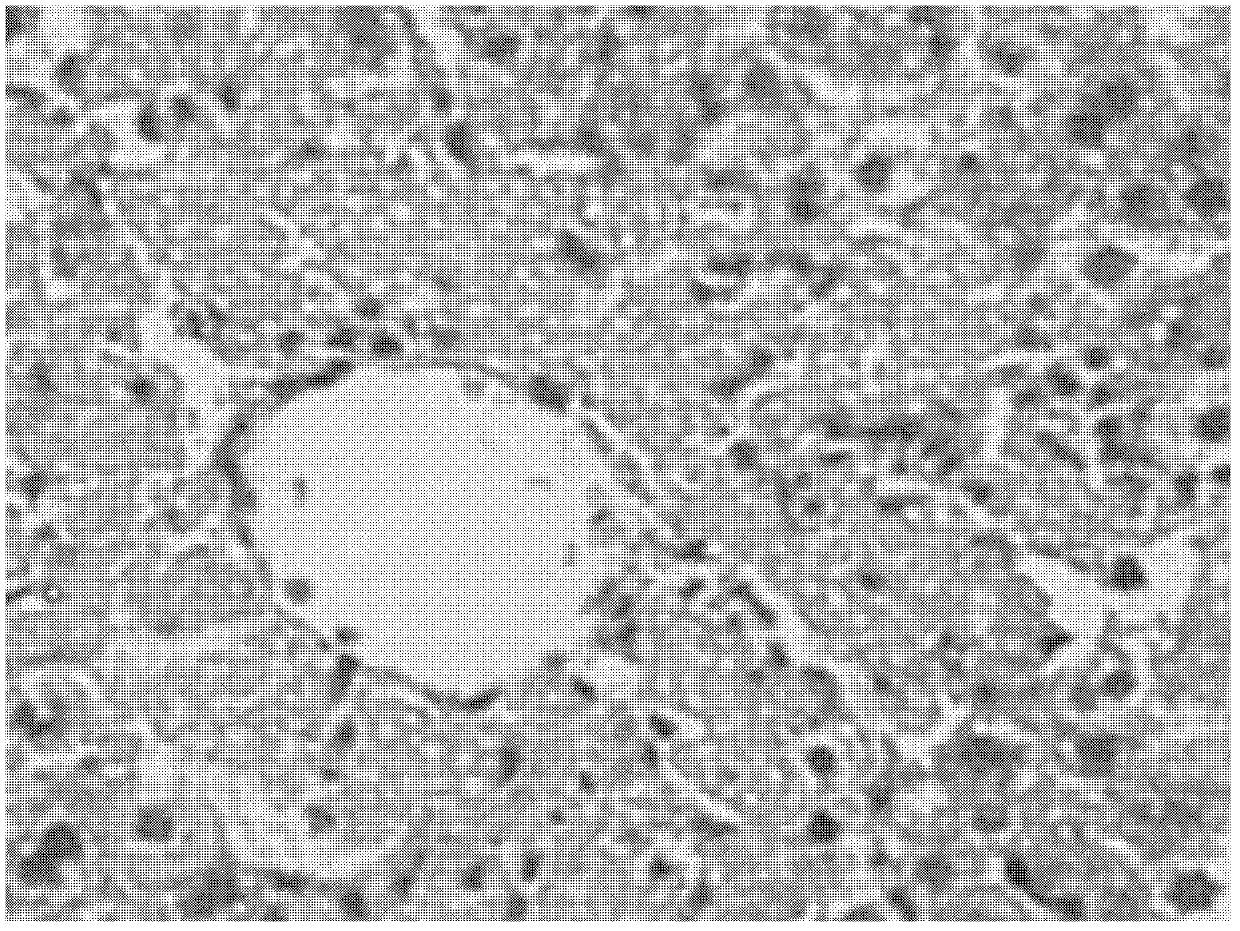 Application of medicine composition in preparation of medicines for preventing or treating fatty liver