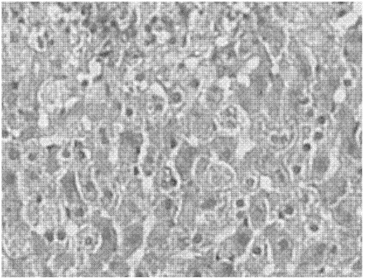 Application of medicine composition in preparation of medicines for preventing or treating fatty liver