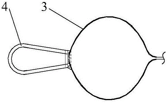 Excised tissue extractor