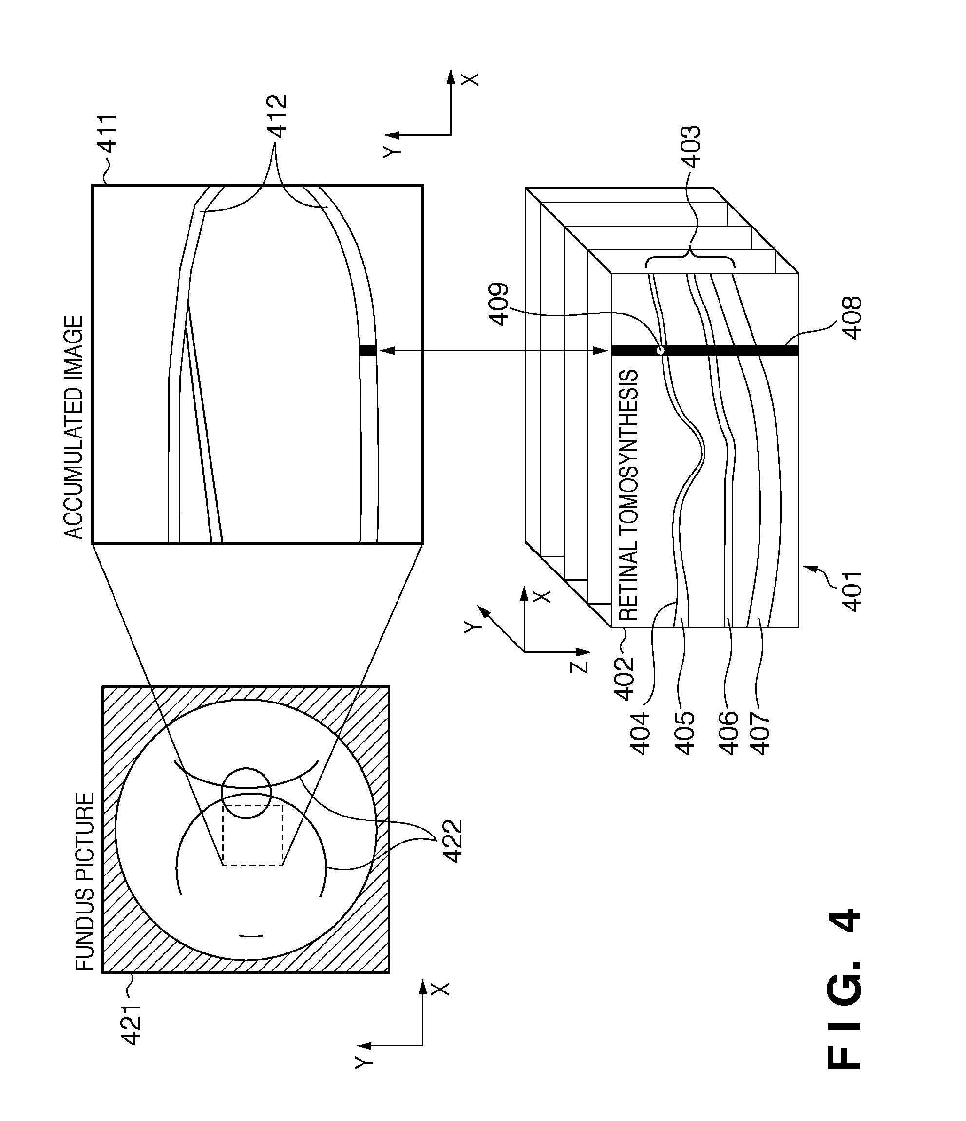 Fundus image display apparatus, control method thereof and computer program