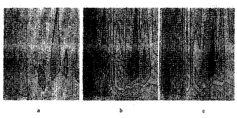 Method for effectively removing fishy smell of chub surimi