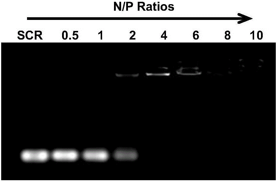 Nanometer vesicle capable of simultaneously achieving RNA interference and MR imaging and preparation method and application thereof