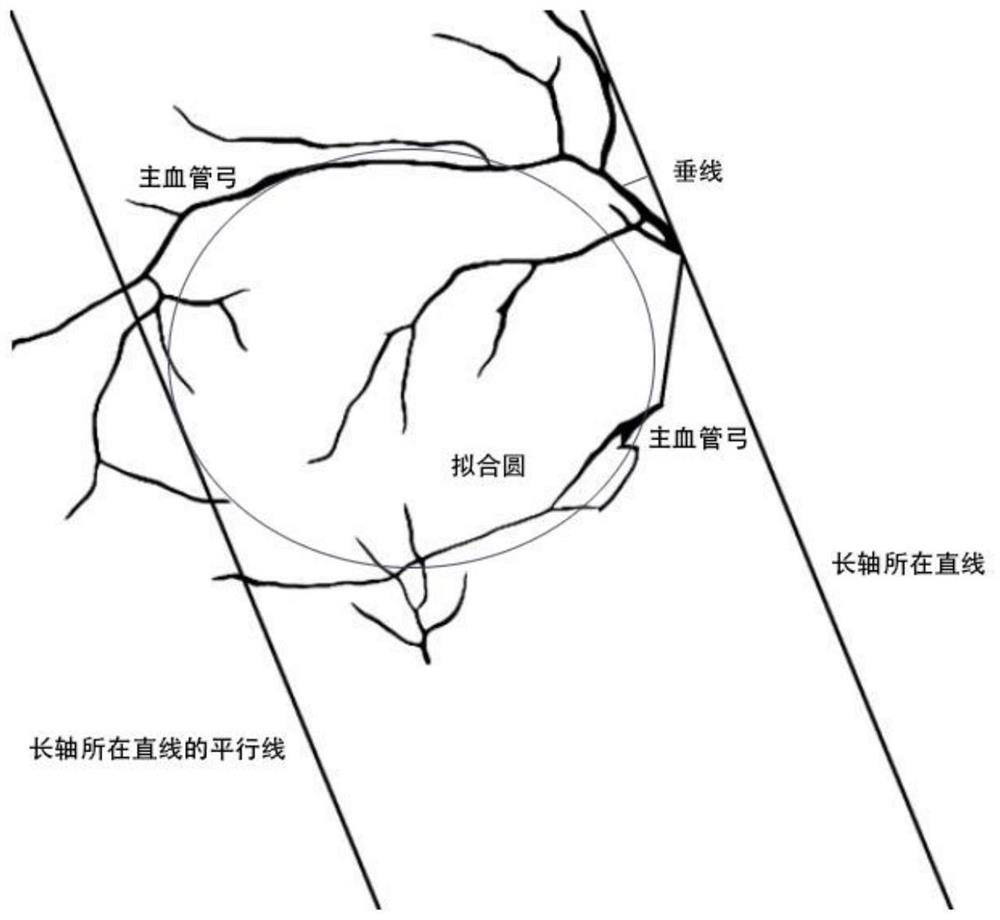 Macular area positioning system based on retina structure