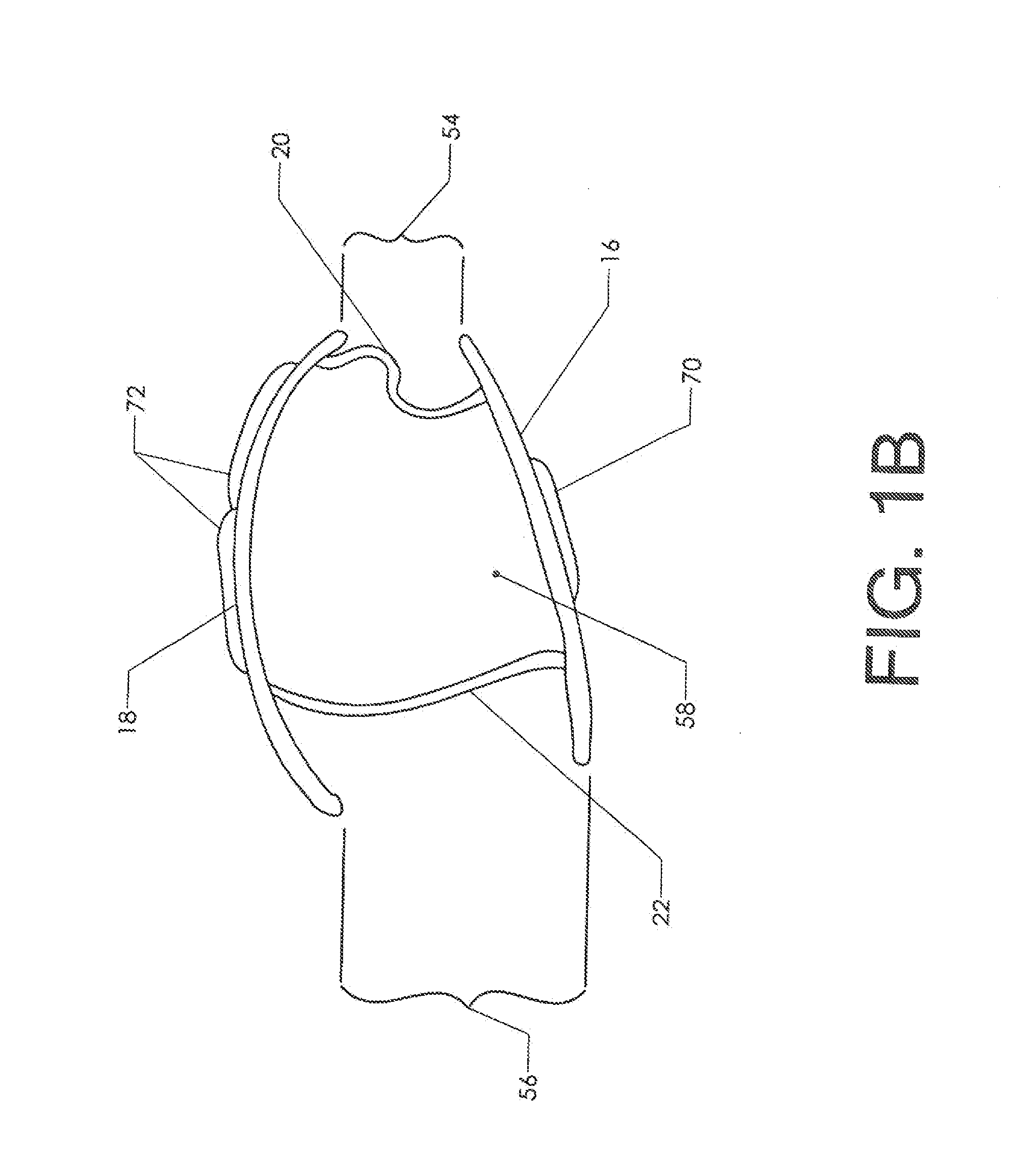 Wrist Orthotic Including Adjustable Ulna Gap