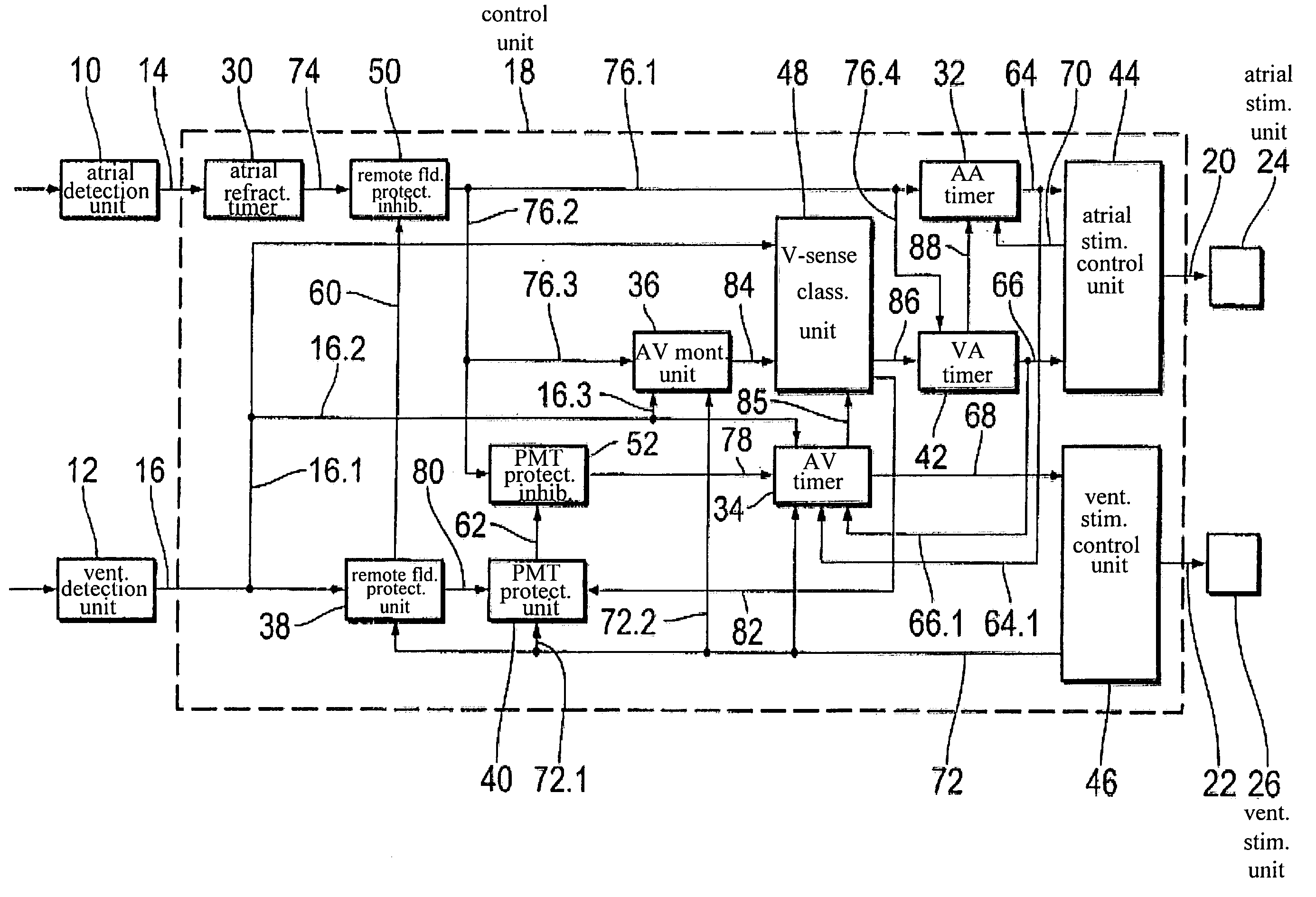 Pacemaker control dependent on natural AV conduction or PVC/VES detection