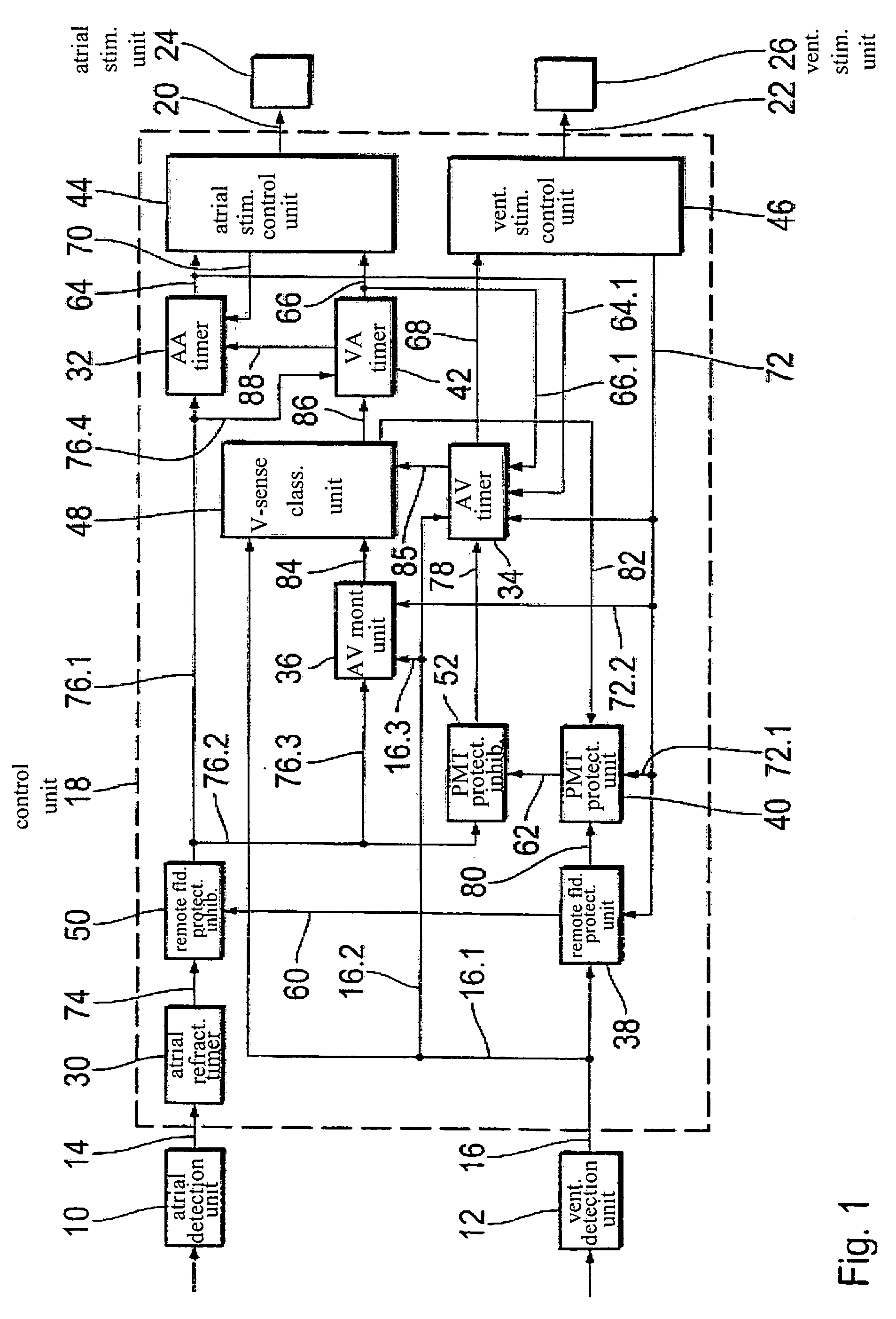 Pacemaker control dependent on natural AV conduction or PVC/VES detection