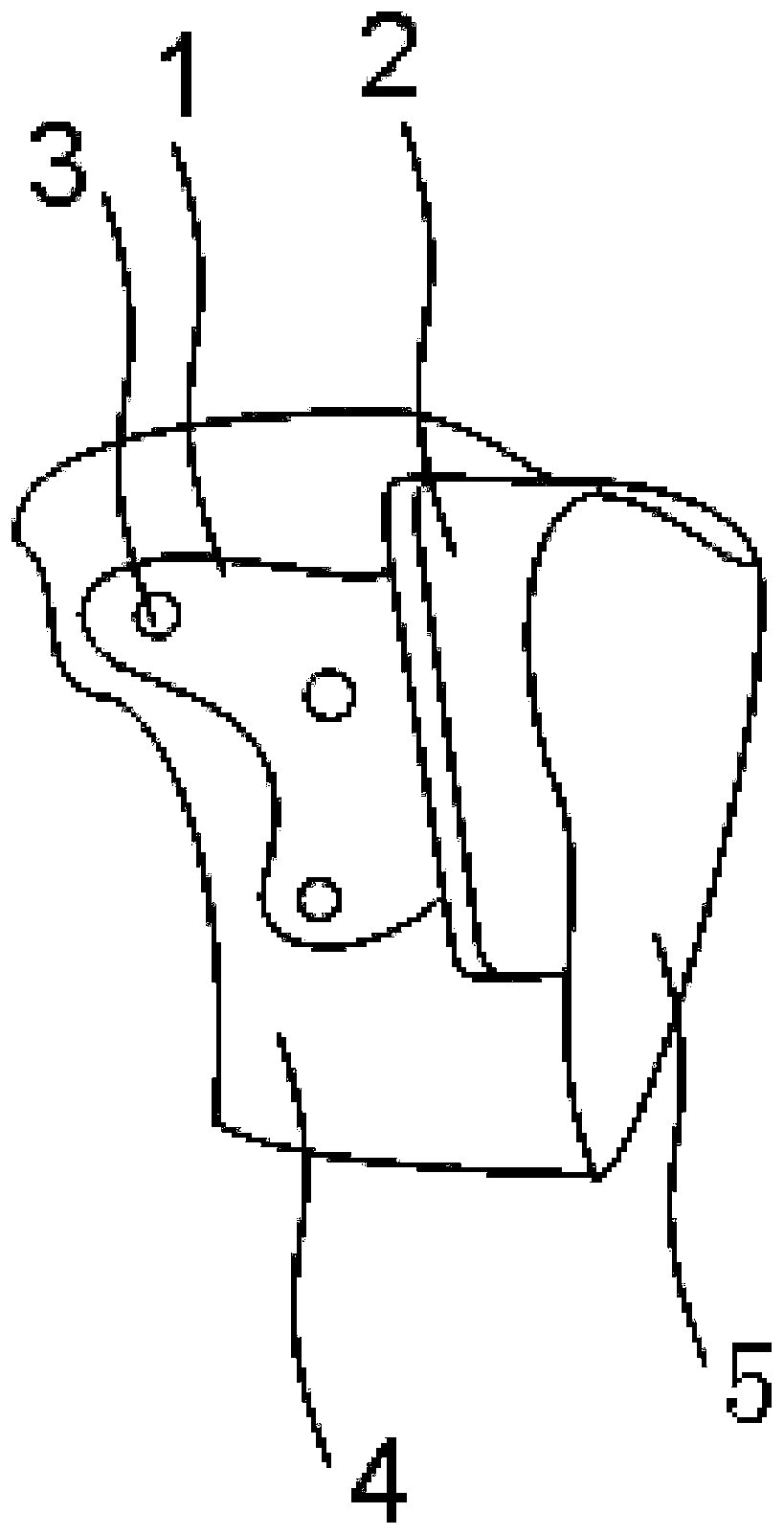 Osteotomy guide plate in operation of precisely treating tibial tuberosity introversion and application of osteotomy guide plate