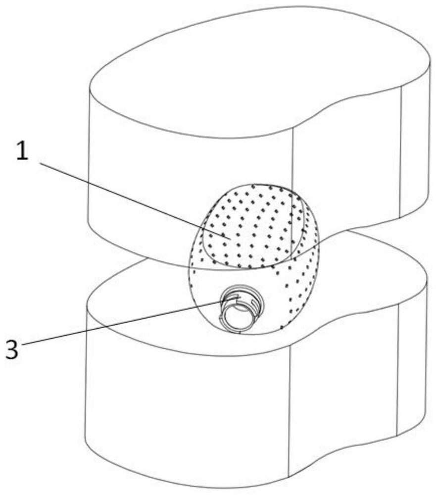 A minimally invasive fusion device