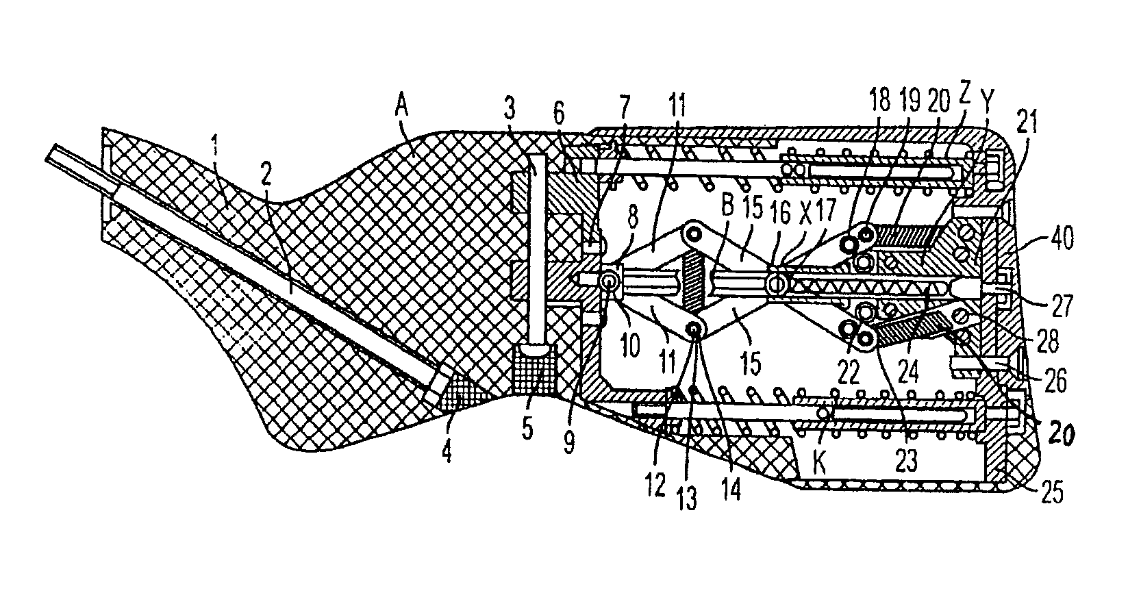 Hunting rifle recoilless buttstock