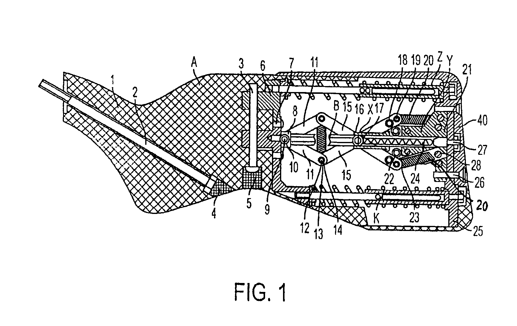 Hunting rifle recoilless buttstock