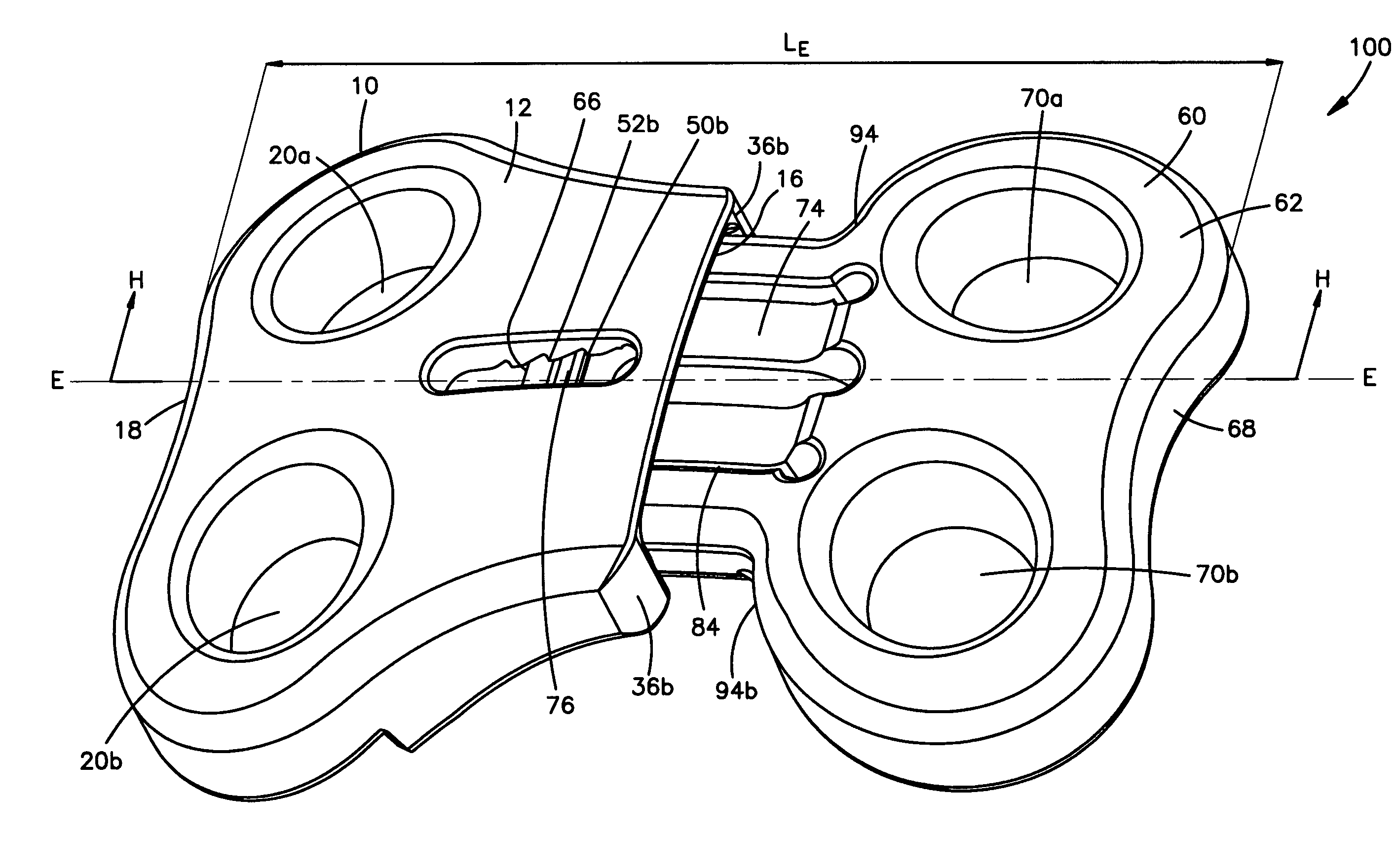 Unidirectional translation system for bone fixation