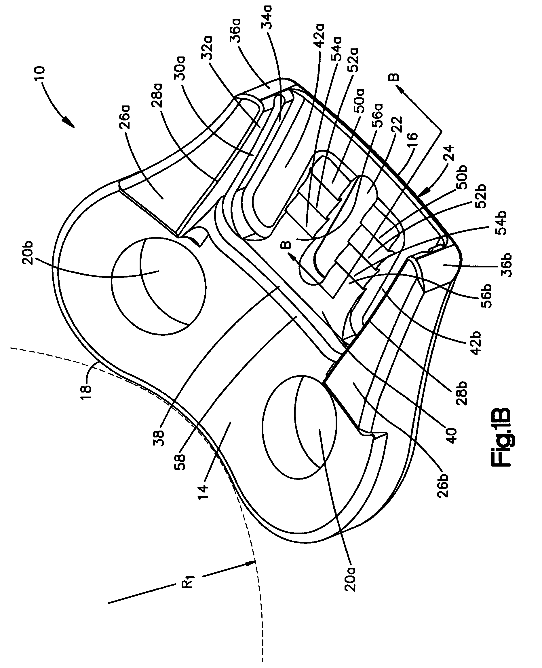 Unidirectional translation system for bone fixation