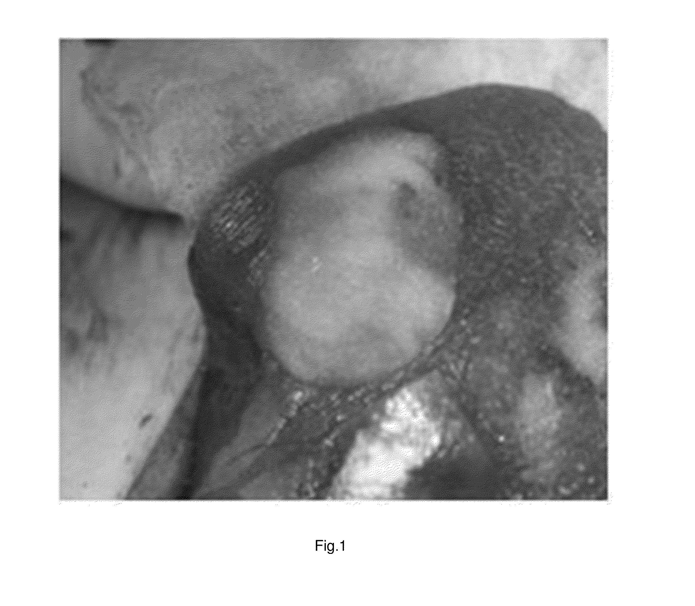 Hemostatic compositions