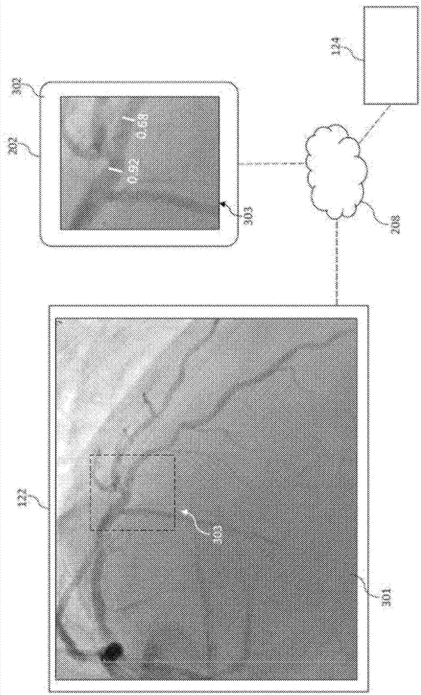 Bedside interface for percutaneous coronary intervention planning