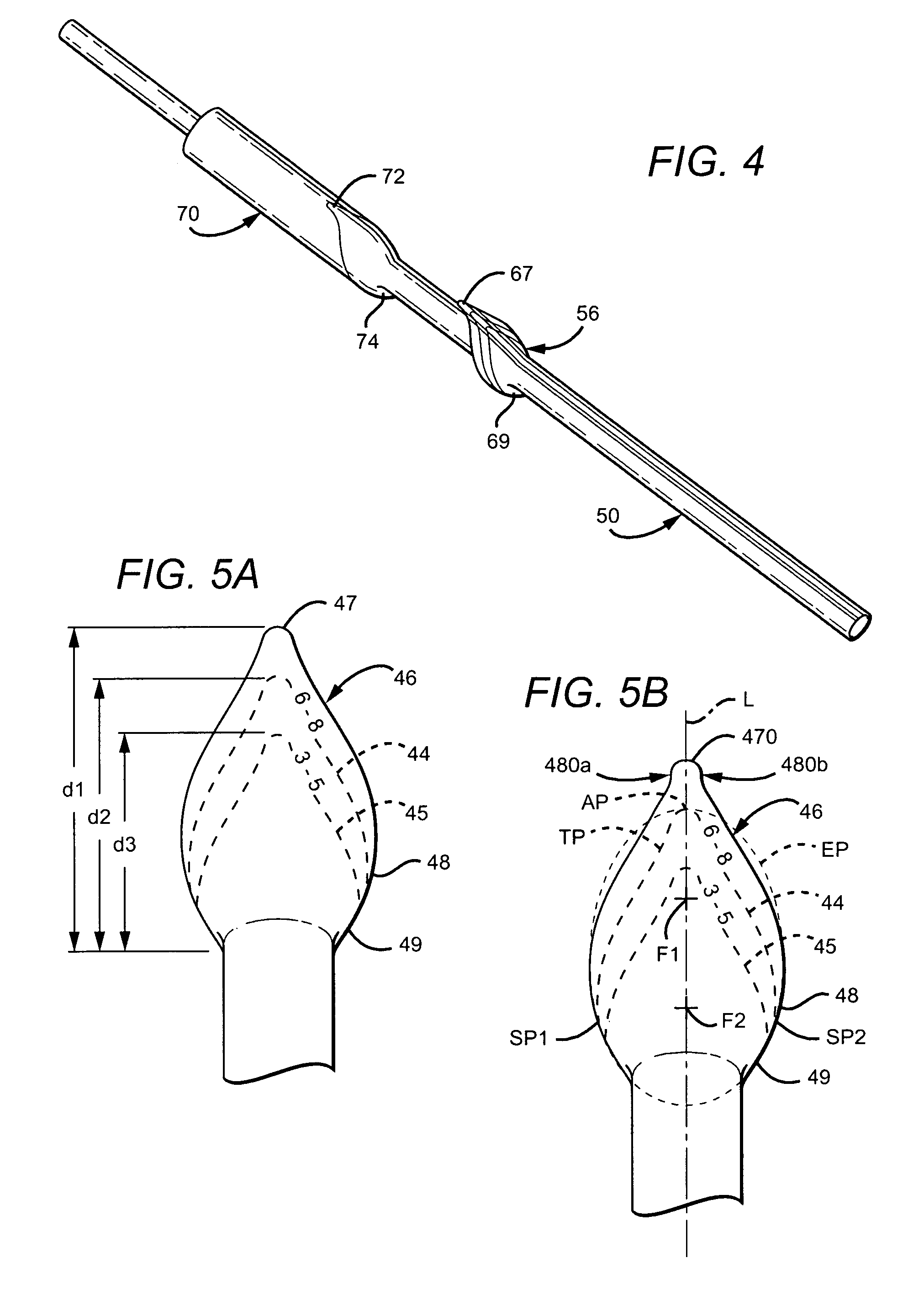 Flanged graft with trim lines