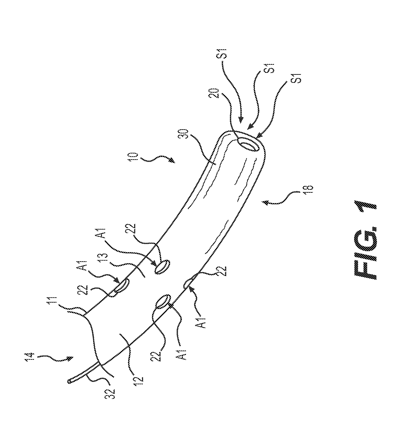 Suction catheter device and method