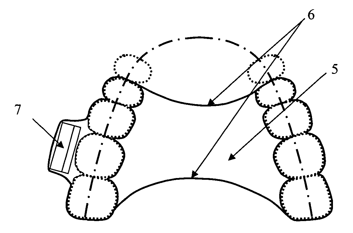 Method and apparatus for tooth bone conduction microphone