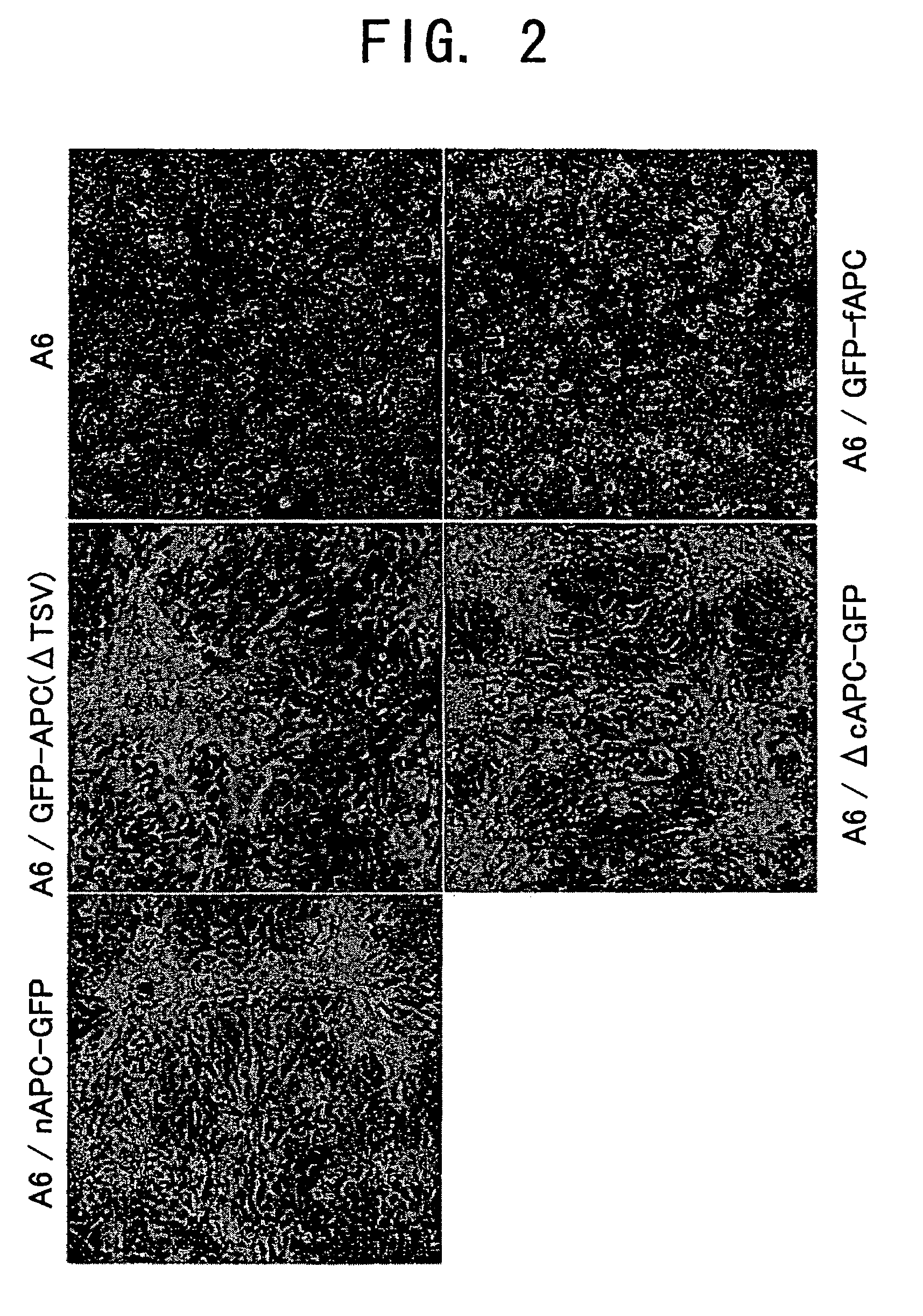 Cultured Xenopus laevis cell lines expressing mutant Adenomatous polyposis coli gene