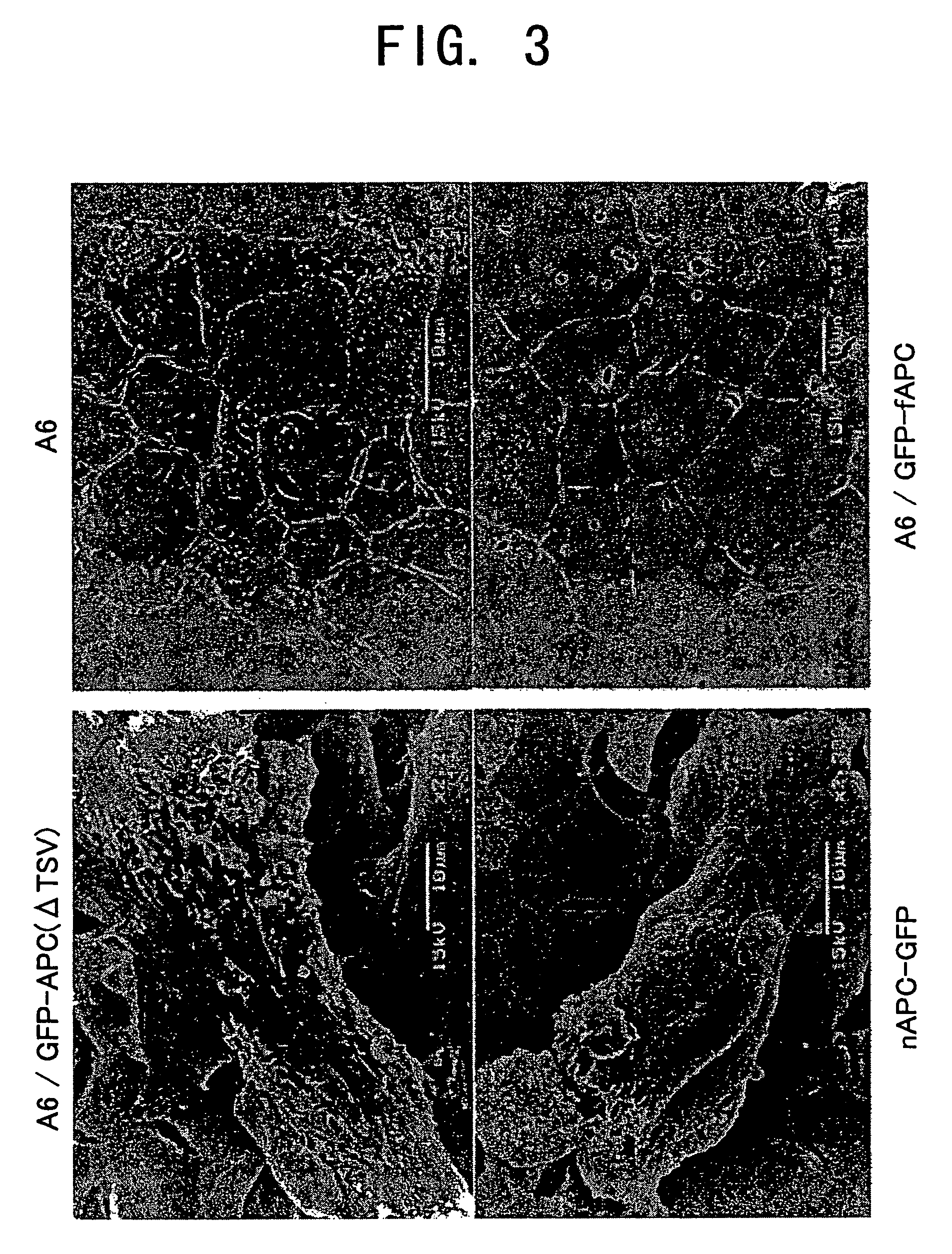 Cultured Xenopus laevis cell lines expressing mutant Adenomatous polyposis coli gene