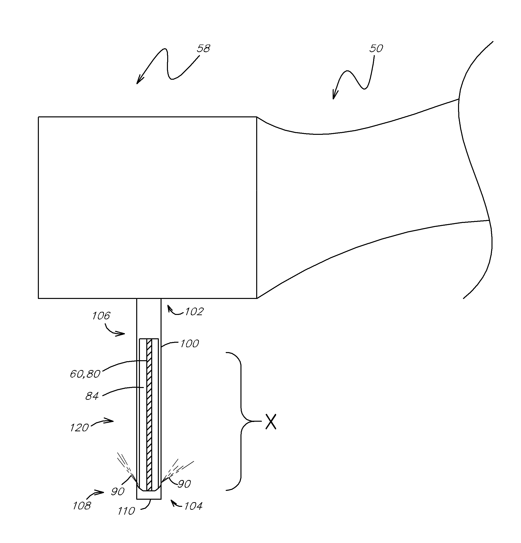 Liquid jet apparatus and methods for dental treatments