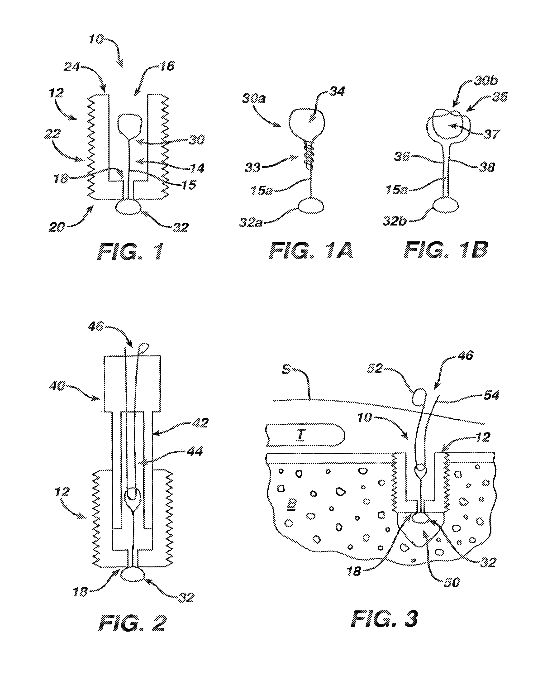 Surgical filament snare assemblies