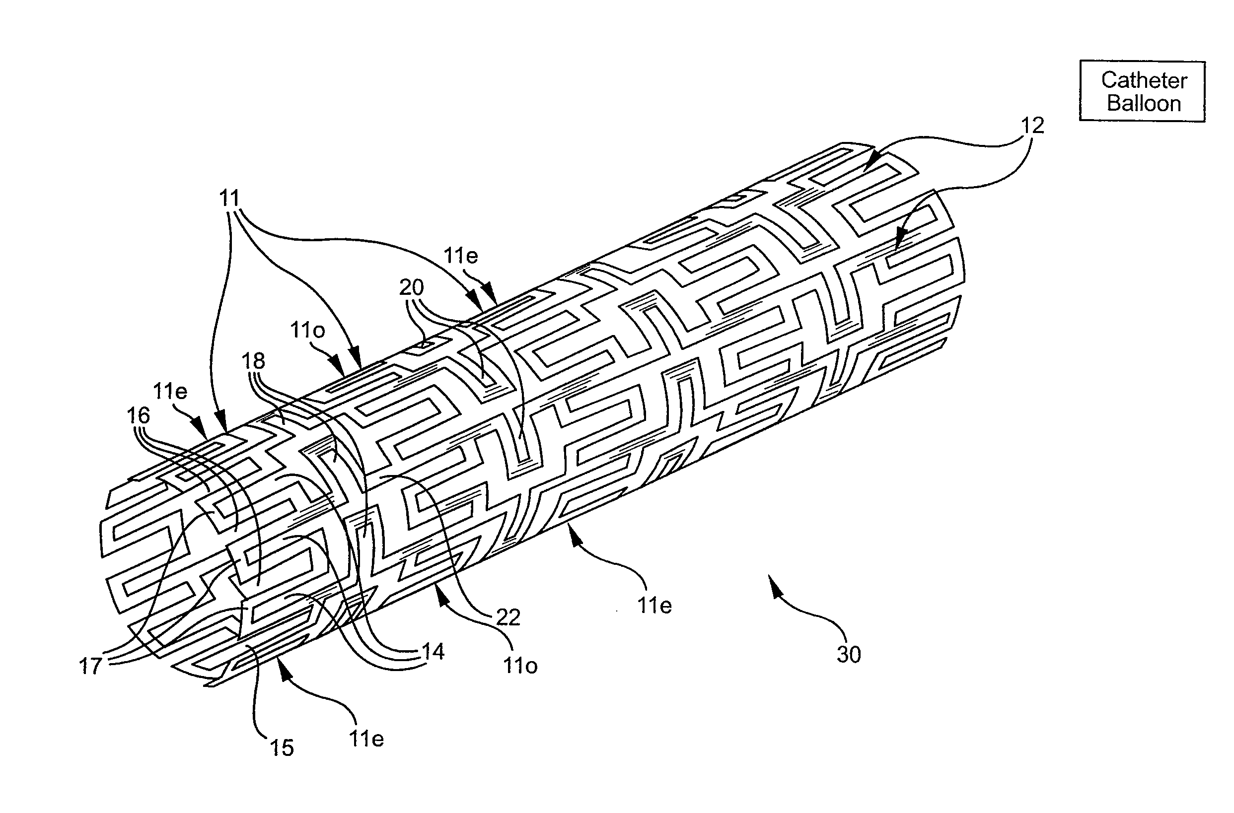 Flexible expandable stent