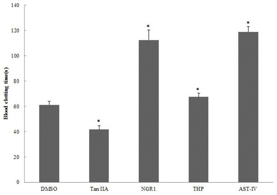 Anti-inflammatory and analgesic compound drug for reducing side effects of rofecoxib and application thereof