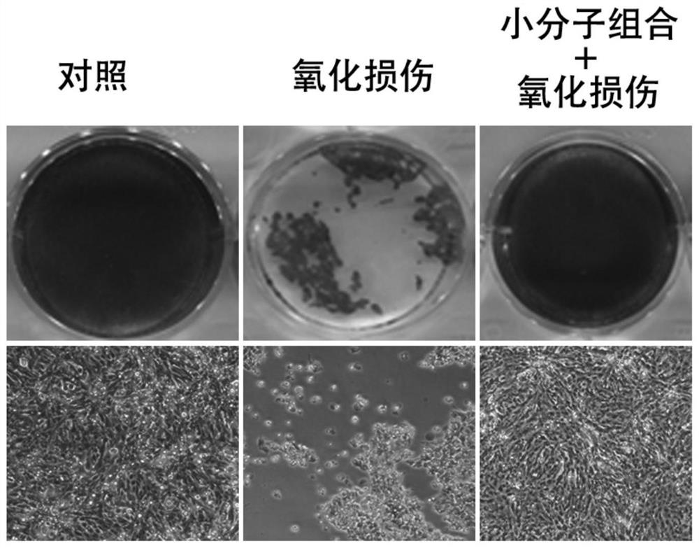 Application of a combination of small molecular compounds in the preparation of drugs for preventing and treating retinal damage diseases