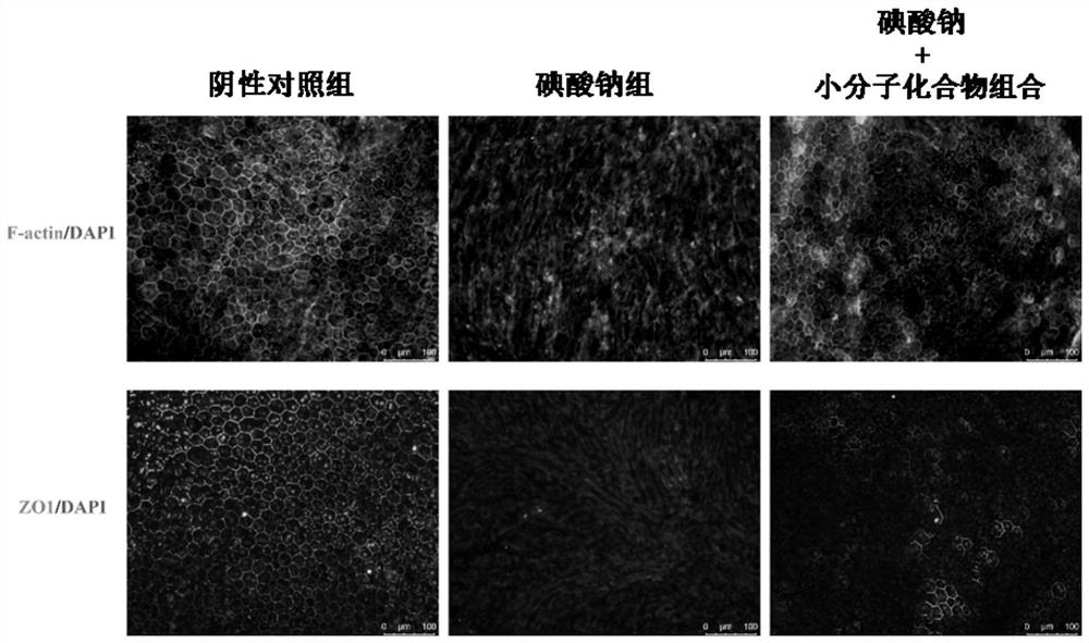 Application of a combination of small molecular compounds in the preparation of drugs for preventing and treating retinal damage diseases