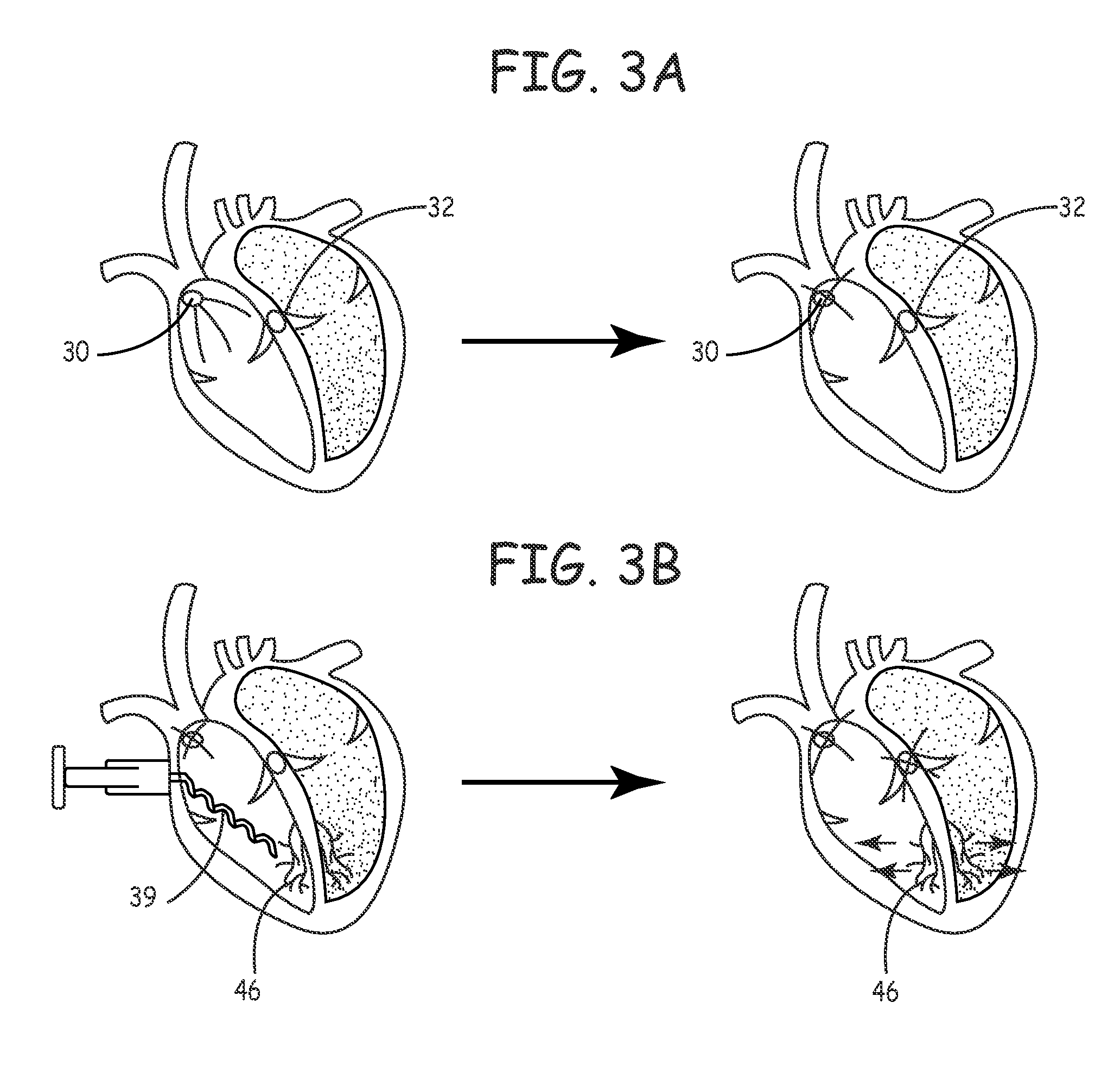 Genetic modification of targeted regions of the cardiac conduction system